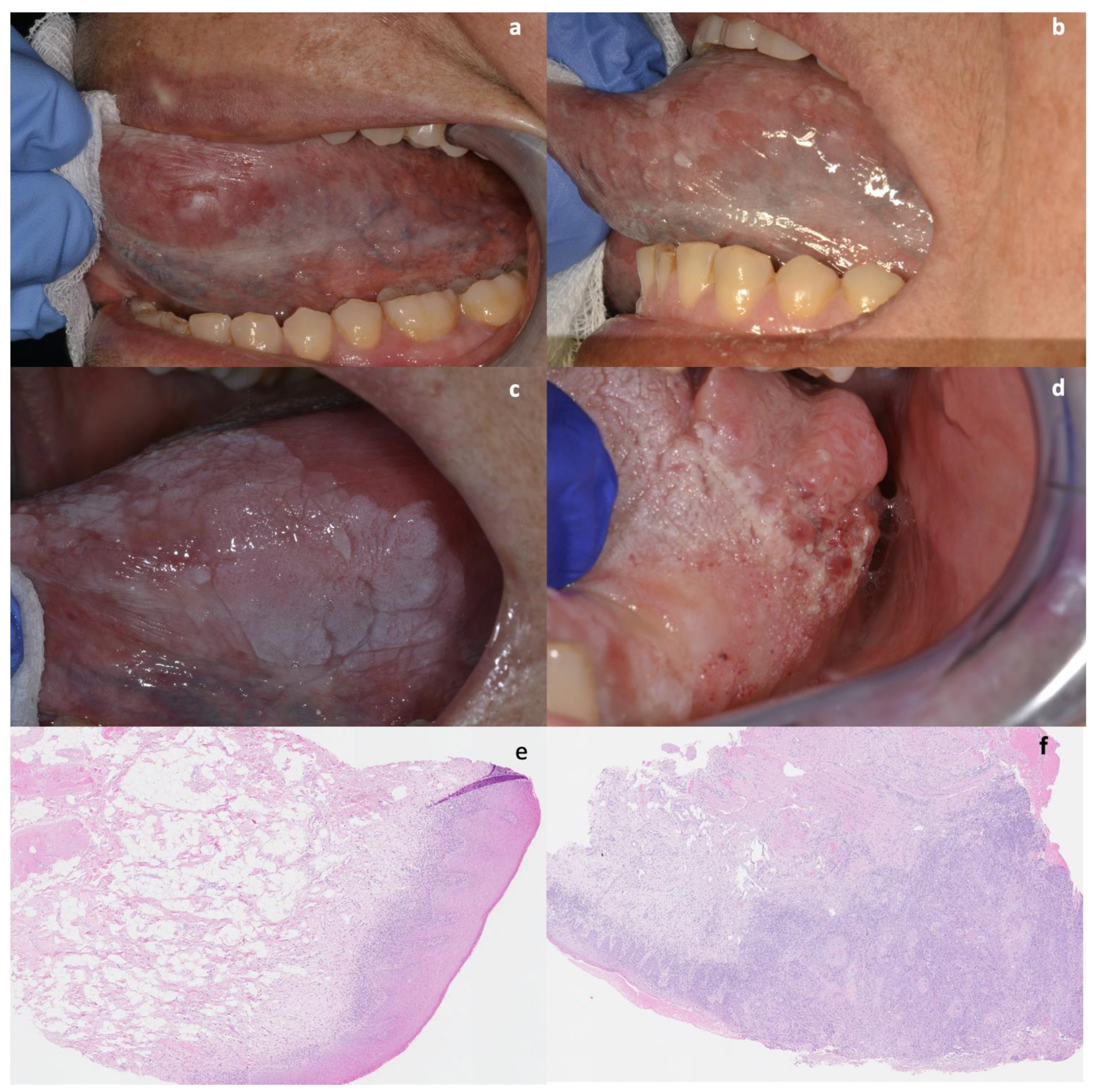 Cancers 13 05740 g001