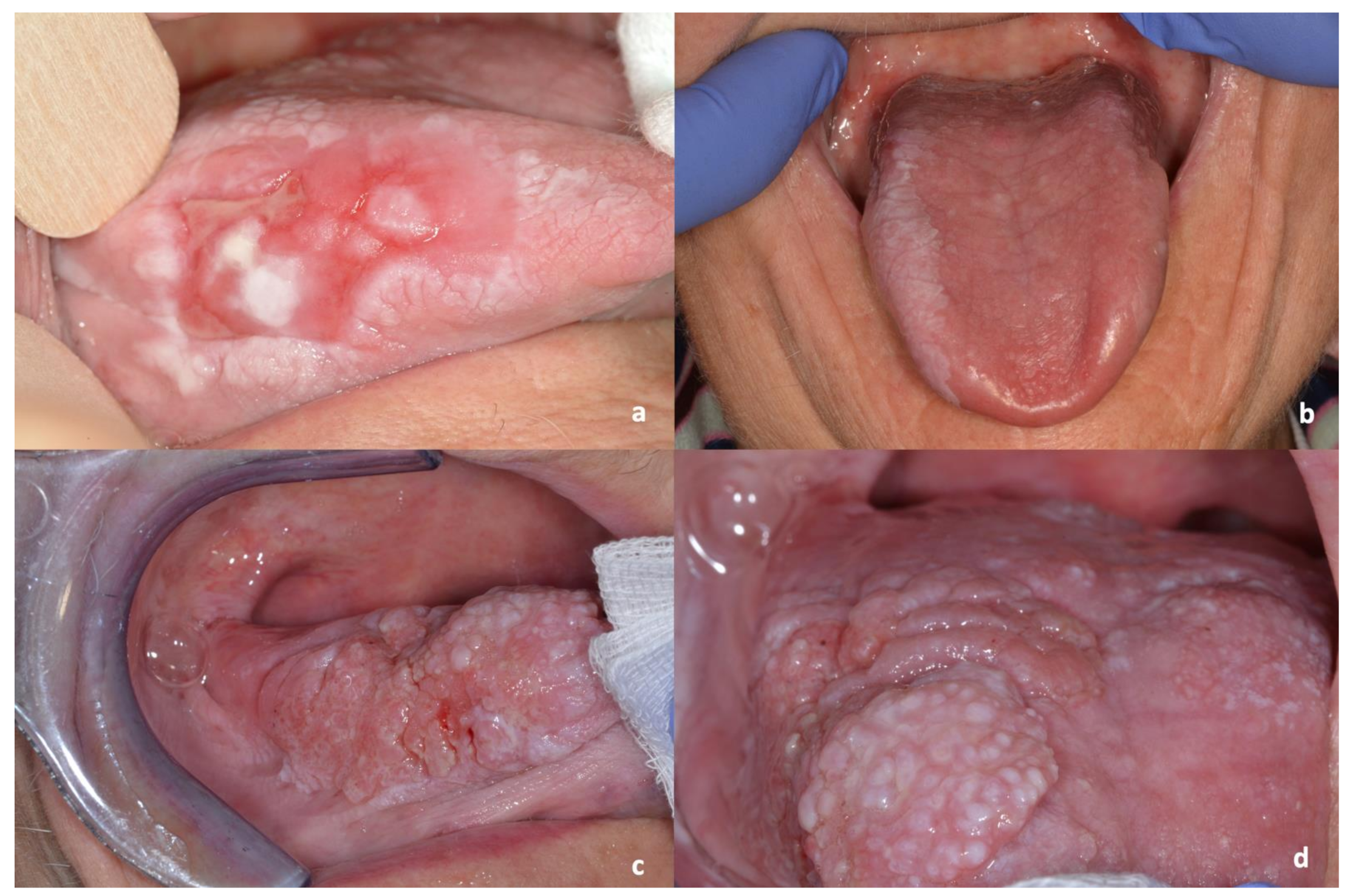 Cancers 13 05740 g002