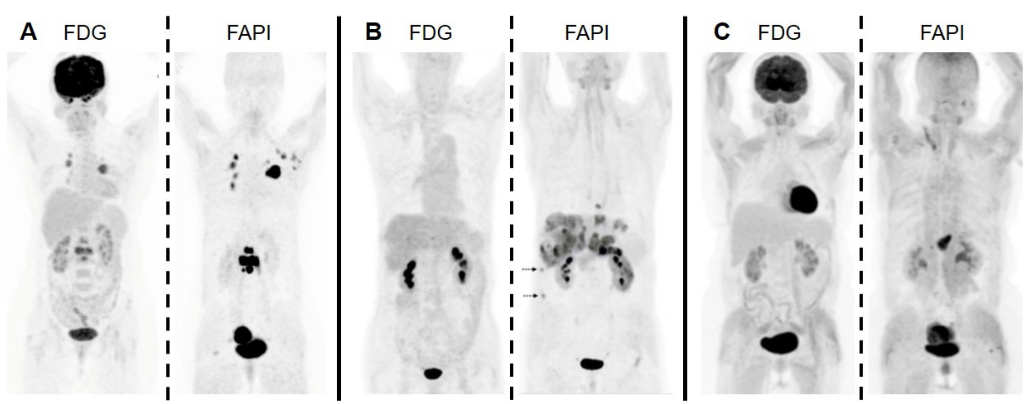 Cancers 13 05744 g005