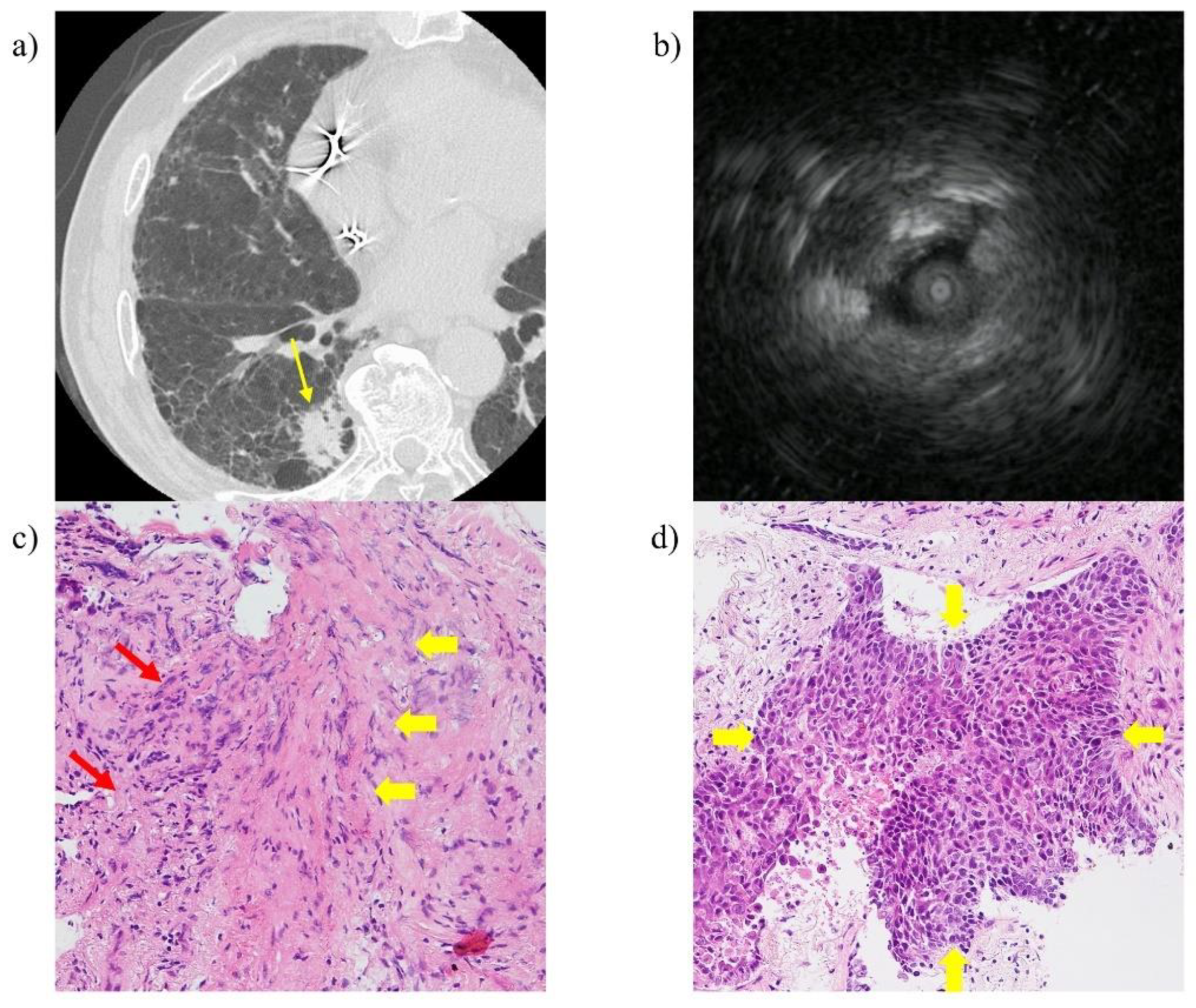 Cancers 13 05751 g003