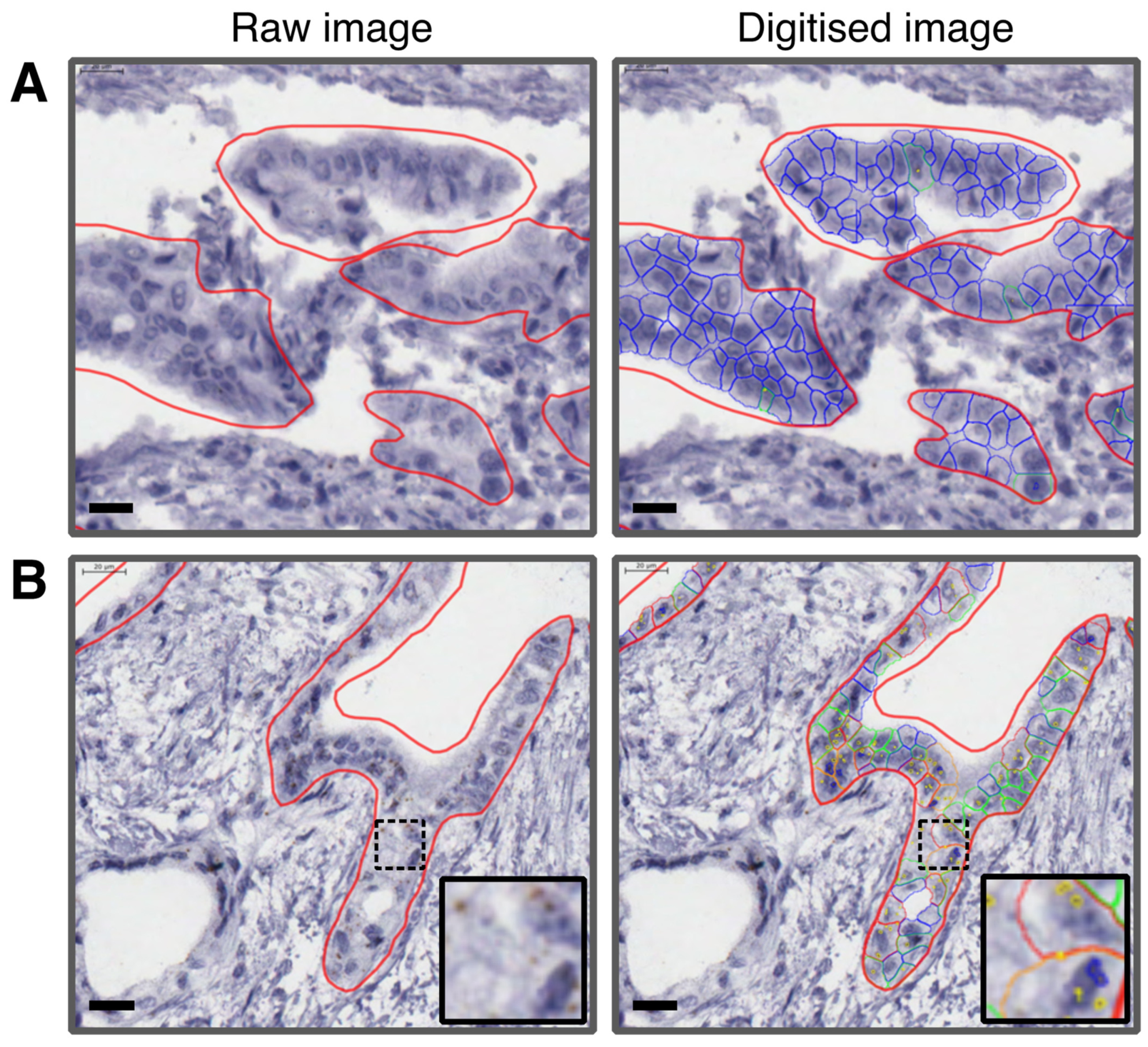 Cancers 13 05758 g001