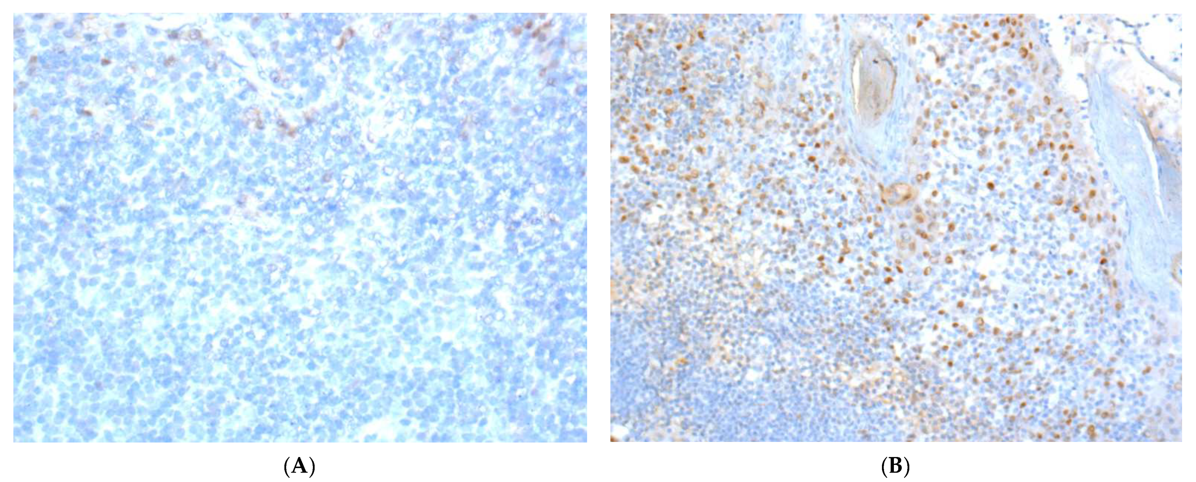 Cancers 13 05763 g001