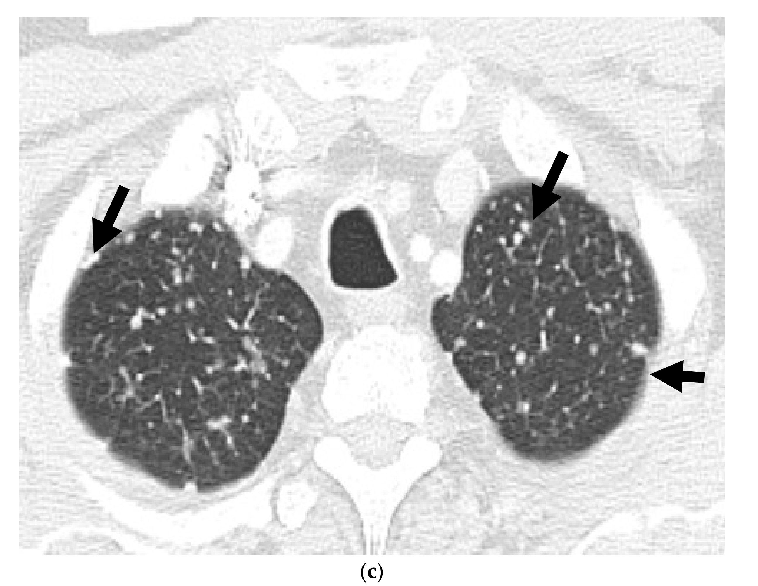 Cancers 13 05765 g002b