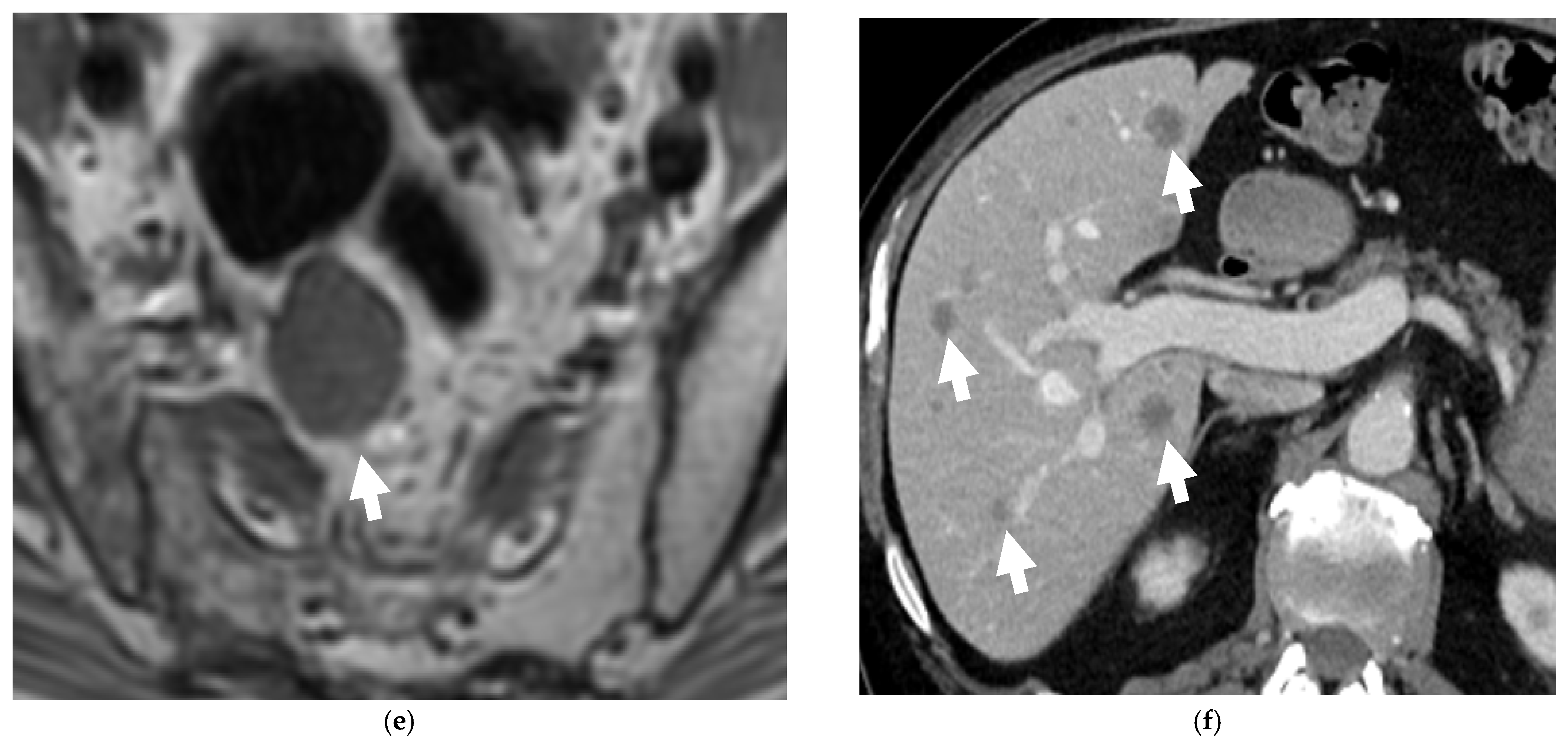 Cancers 13 05765 g003b