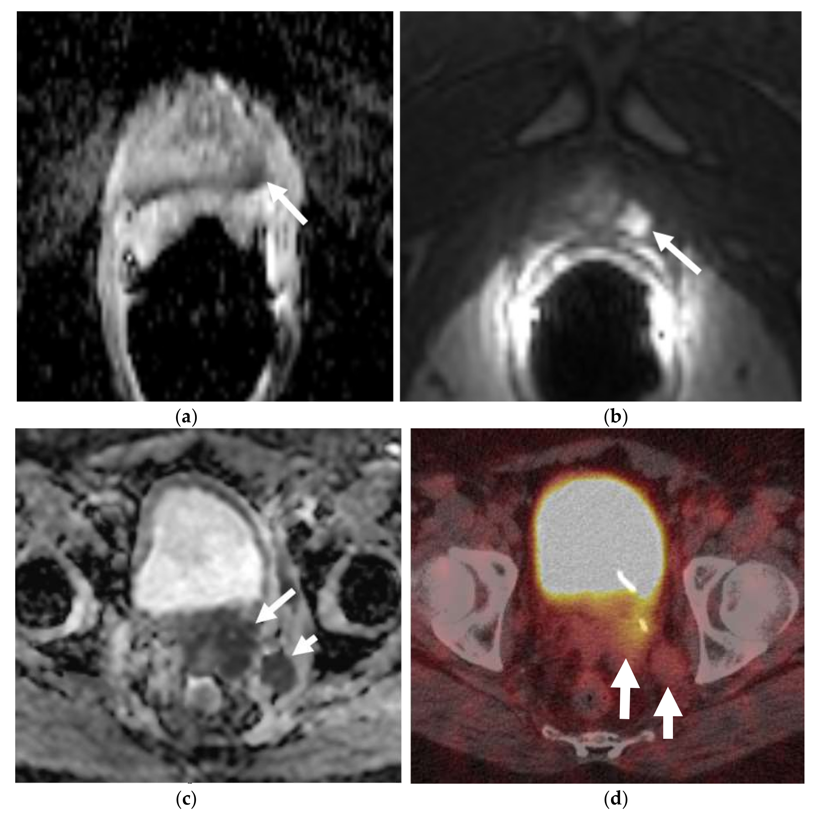 Cancers 13 05765 g004