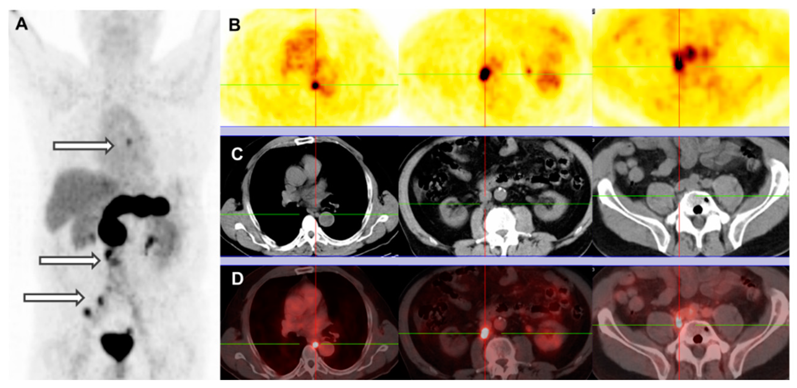 Cancers 13 05766 g004