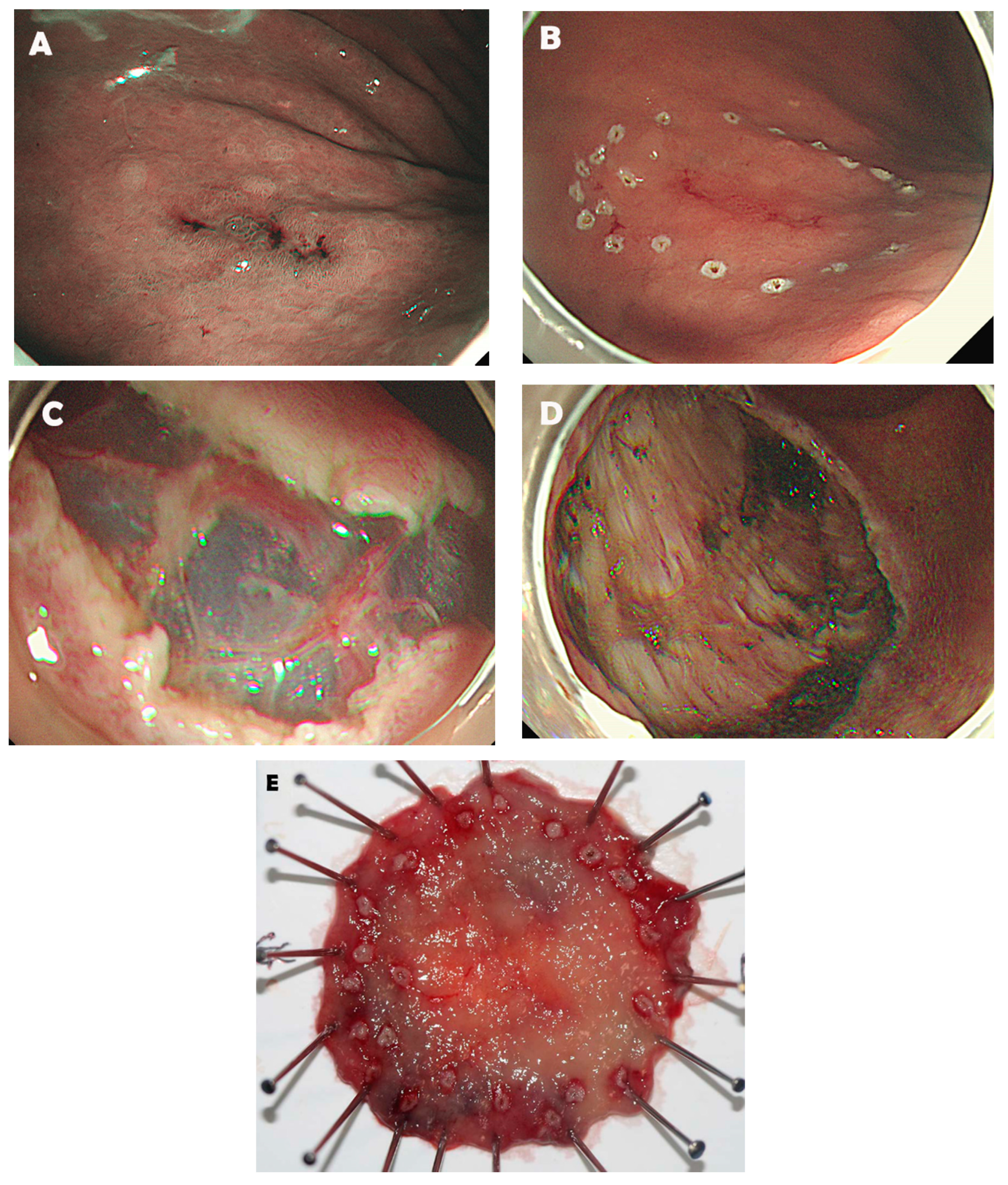 Cancers 13 05768 g001