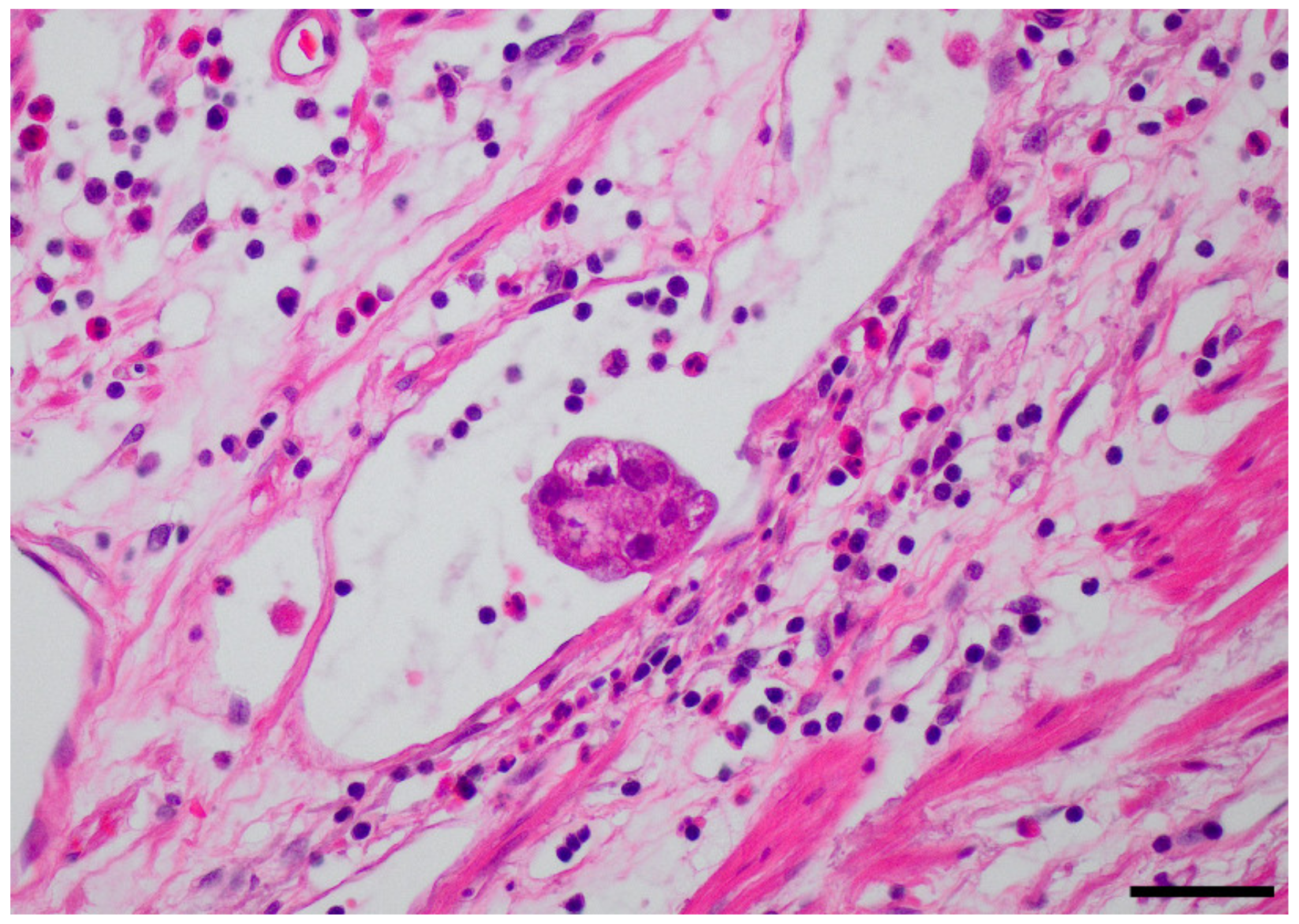 Cancers 13 05768 g003