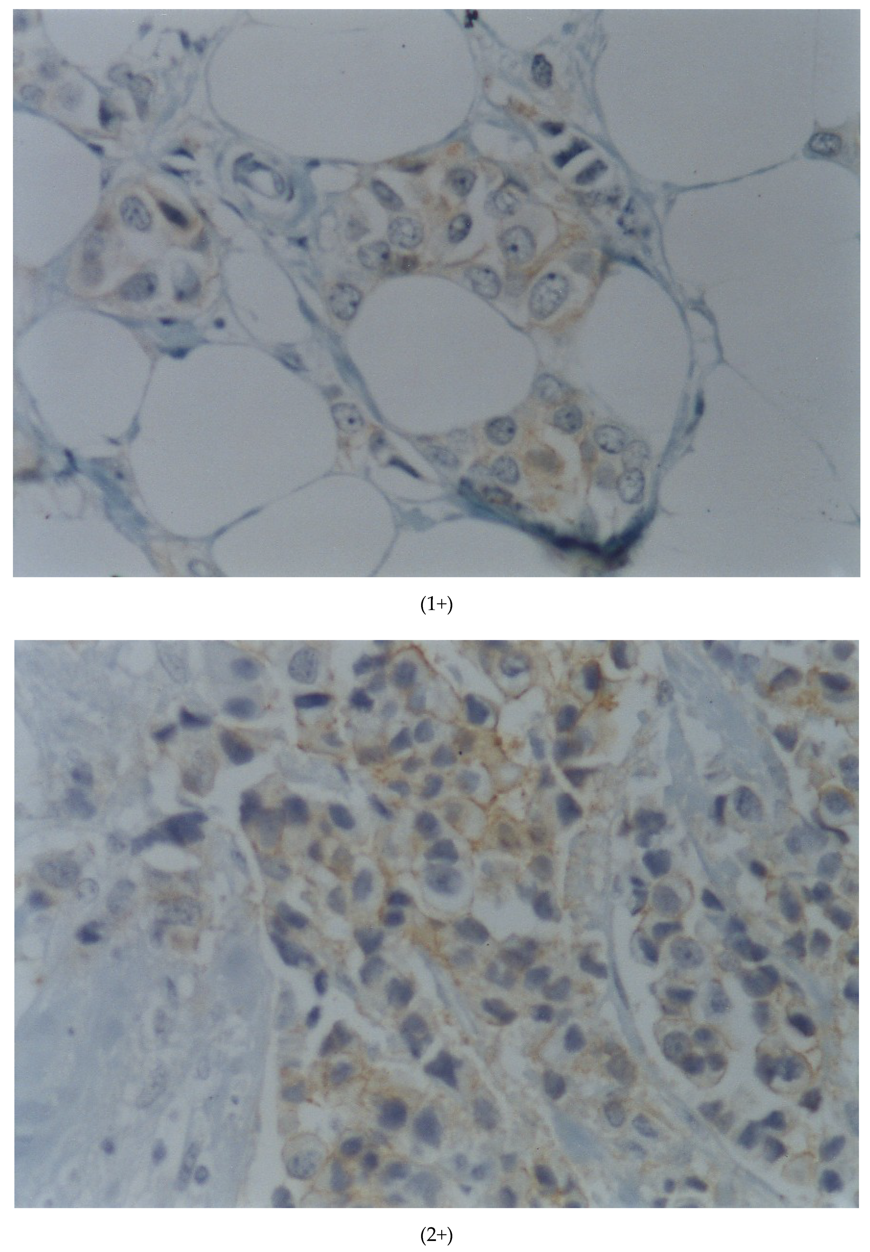 Cancers 13 05771 g002a