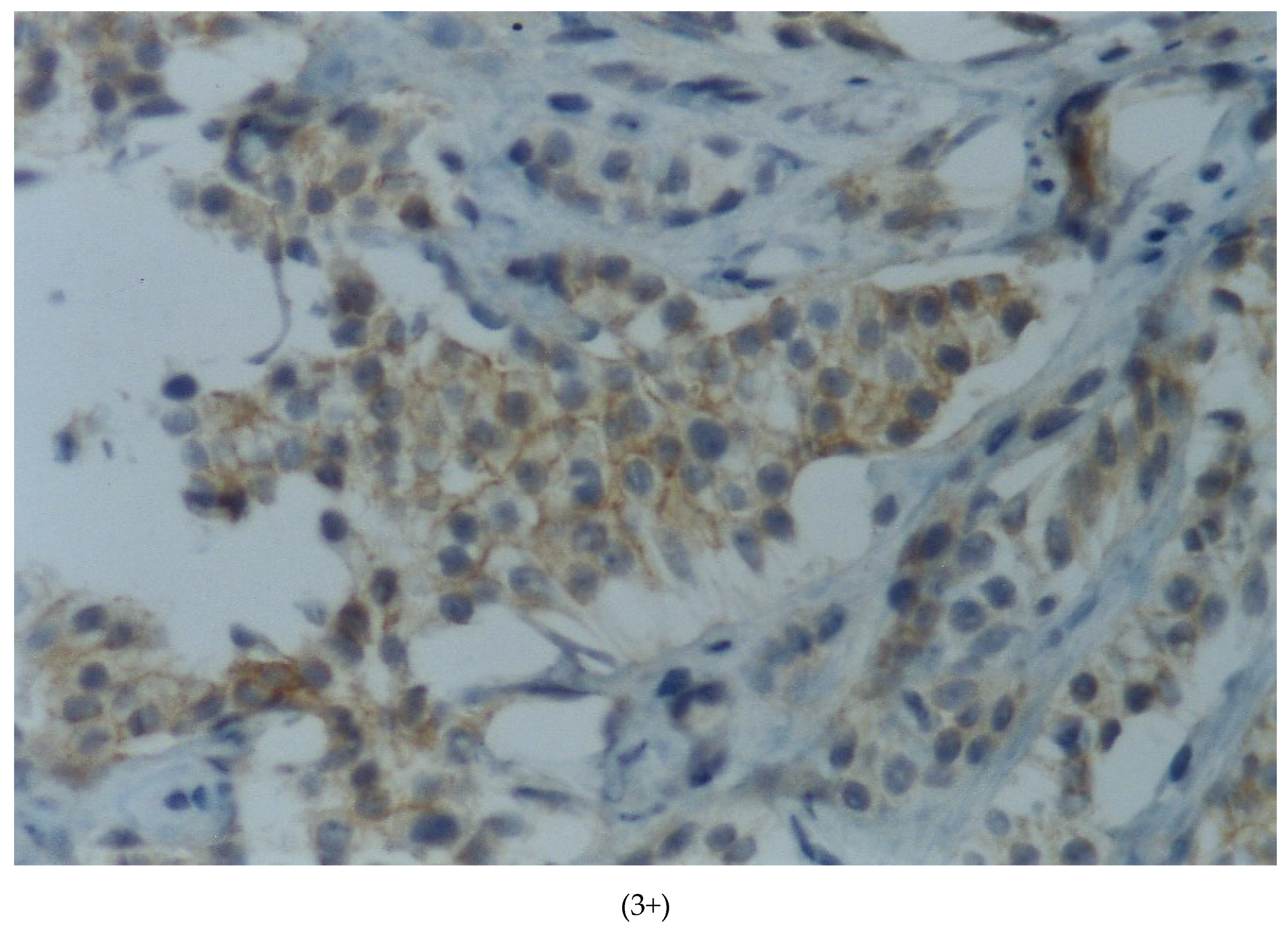 Cancers 13 05771 g002b