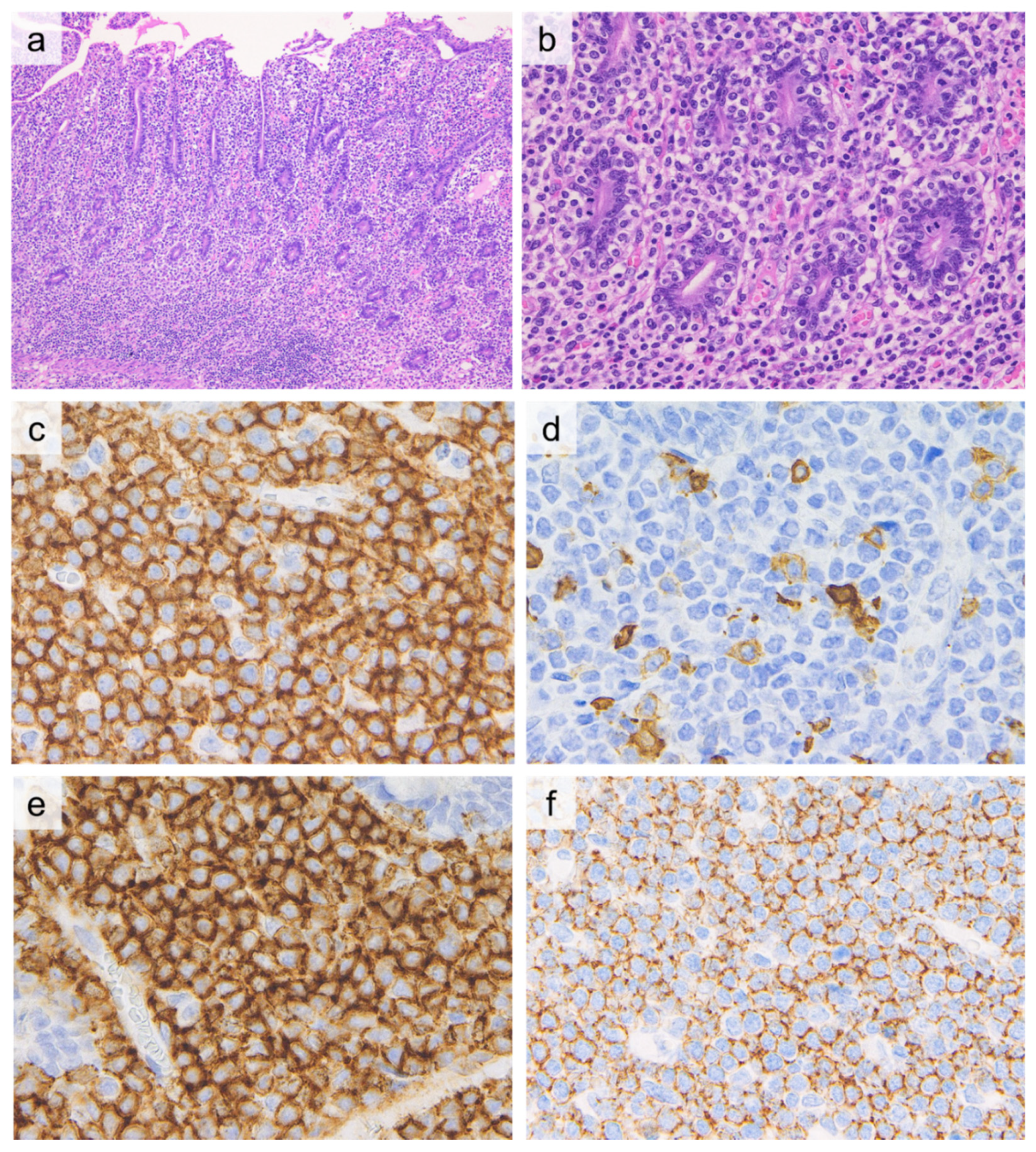 Cancers 13 05774 g001