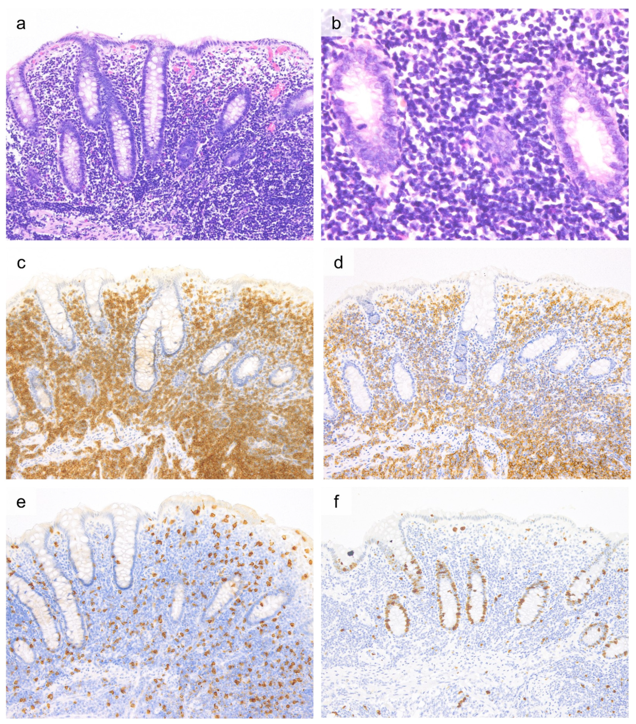 Cancers 13 05774 g003