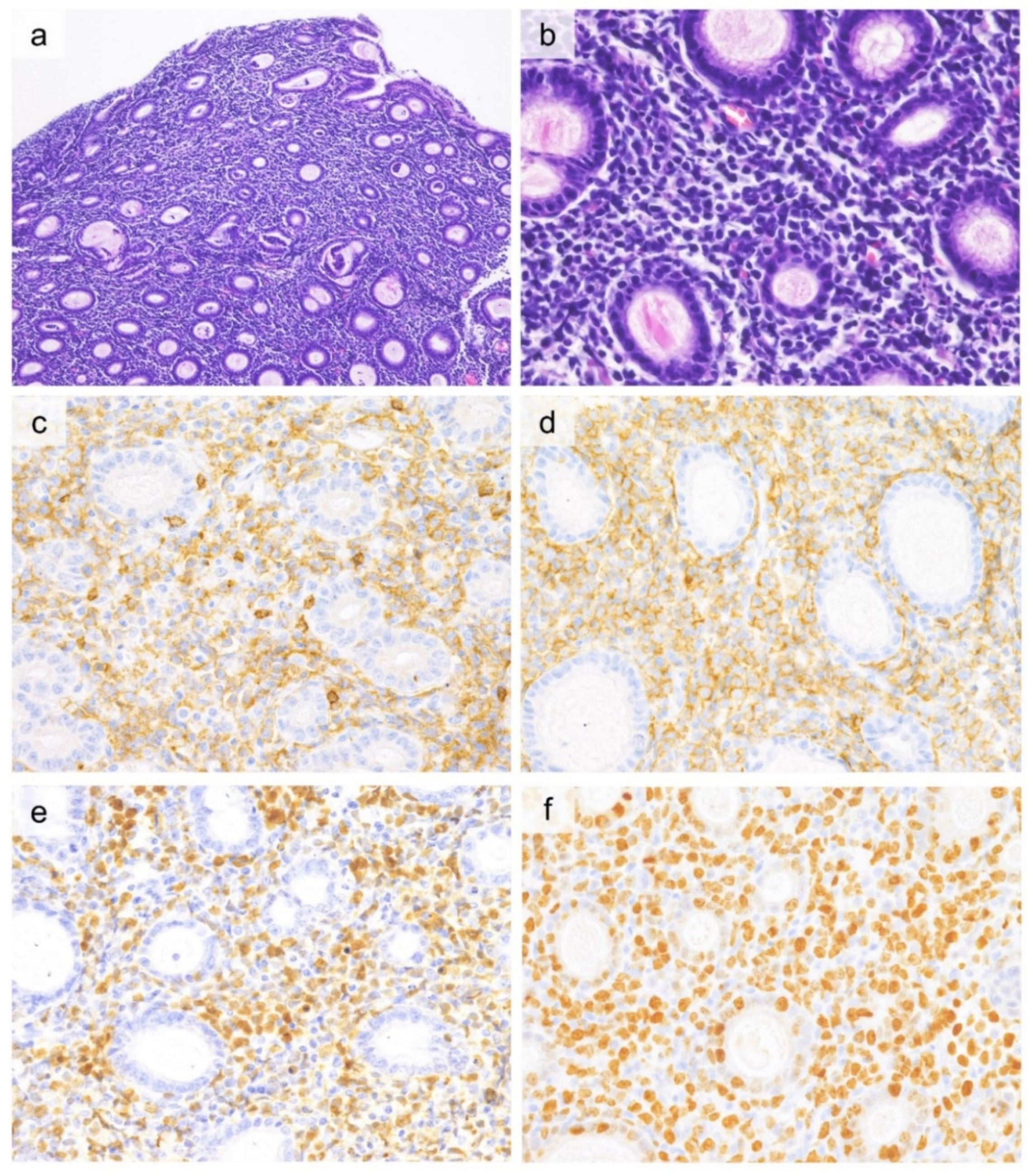 Cancers 13 05774 g005