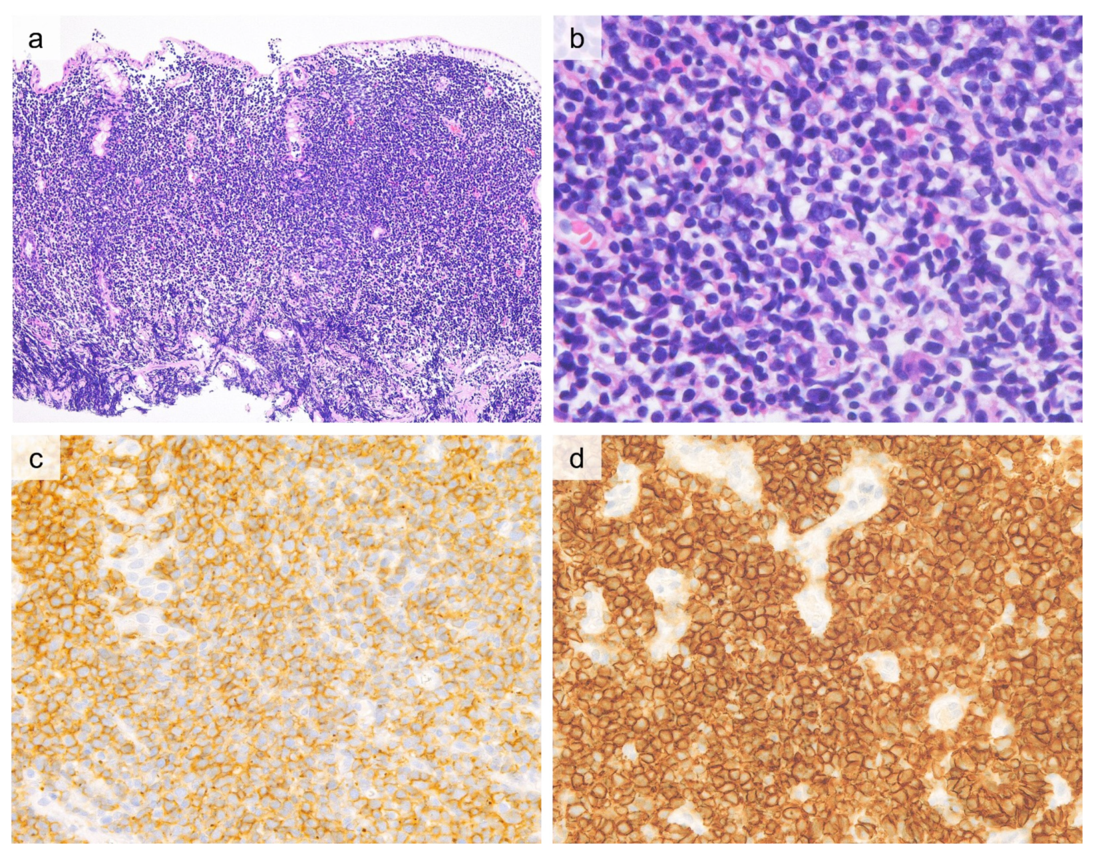 Cancers 13 05774 g006