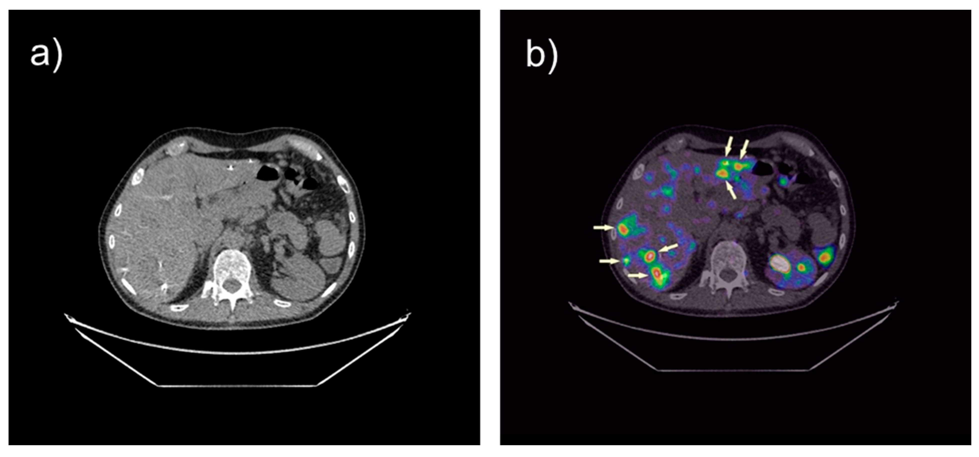 Cancers 13 05776 g003