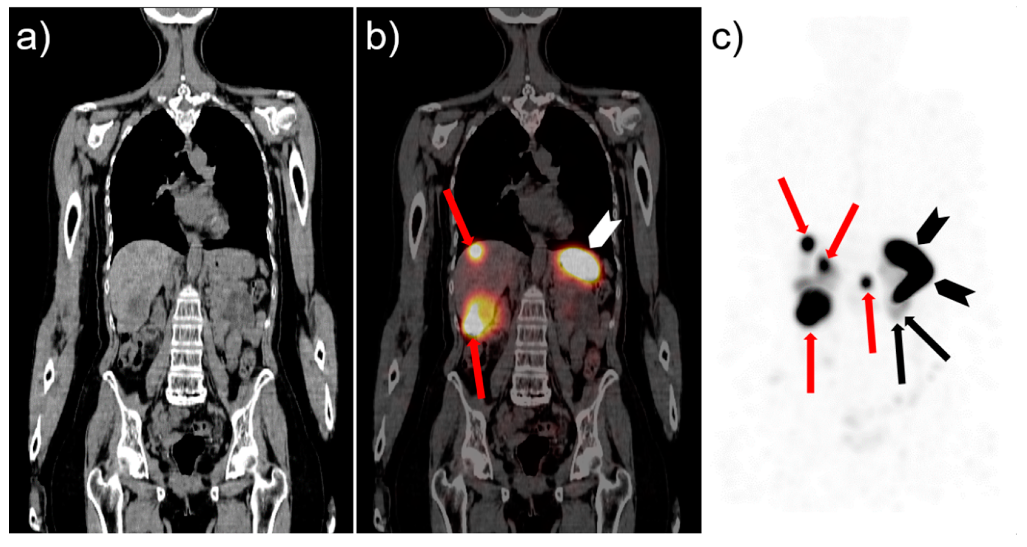 Cancers 13 05776 g004