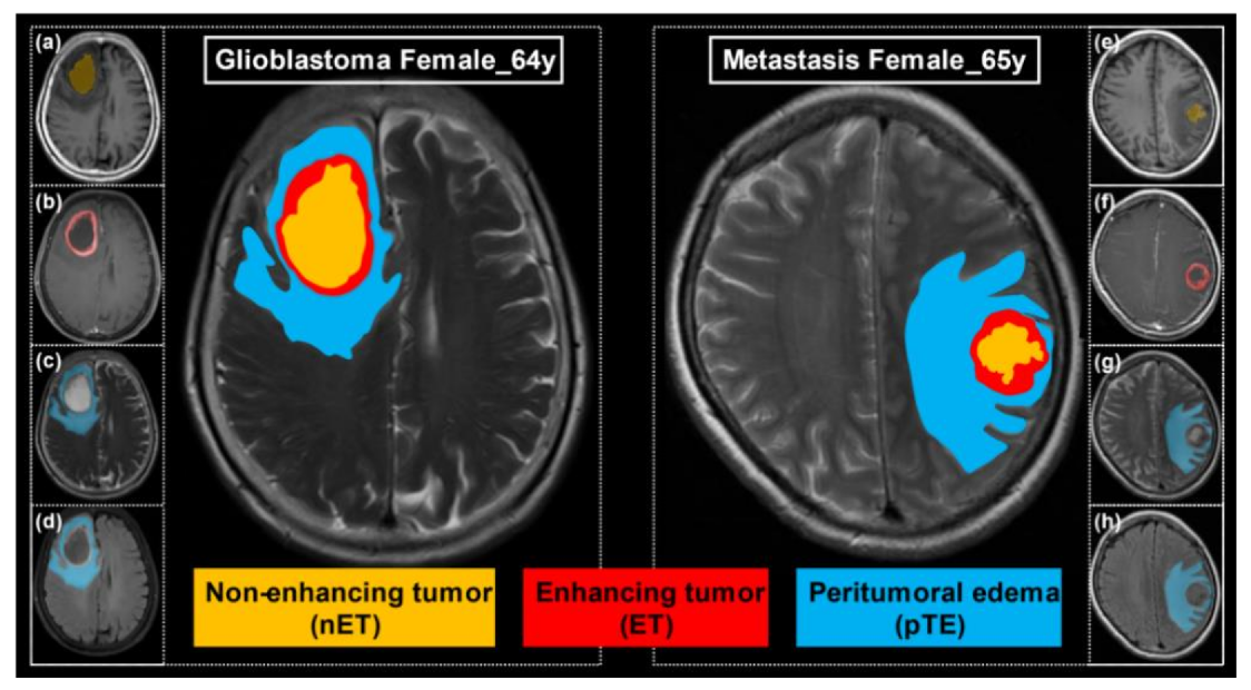 Cancers 13 05793 g002