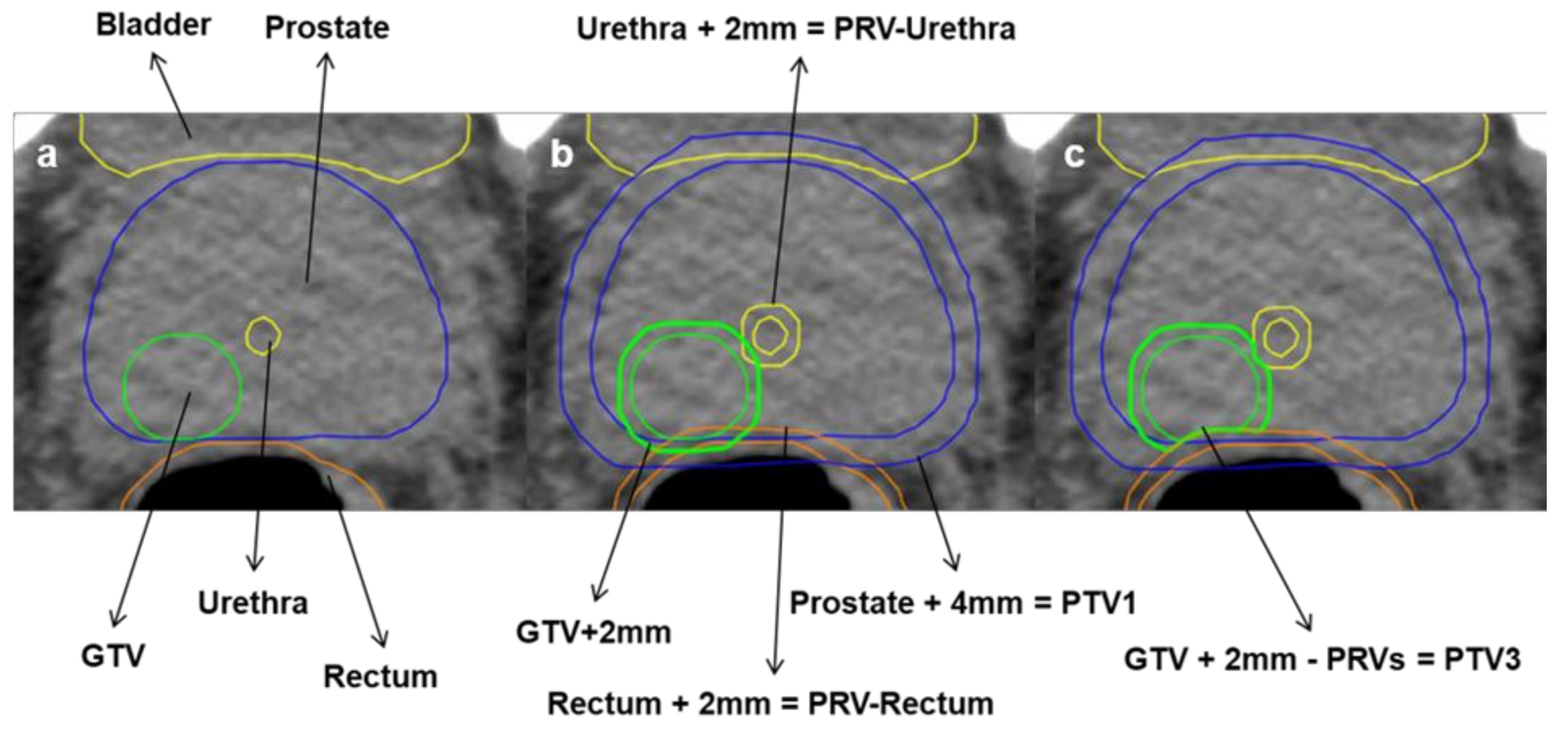 Cancers 13 05795 g002