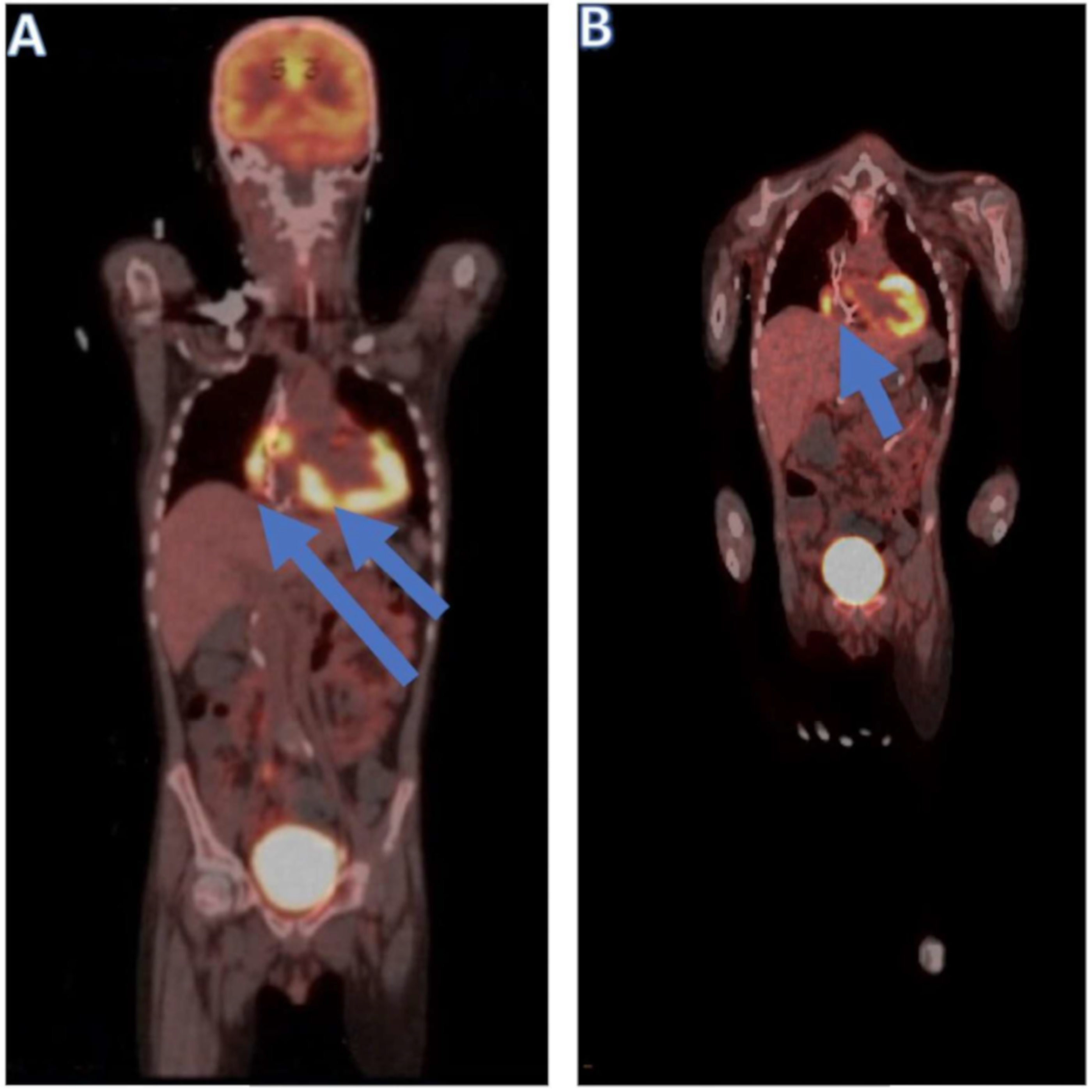 Cancers 13 05814 g004