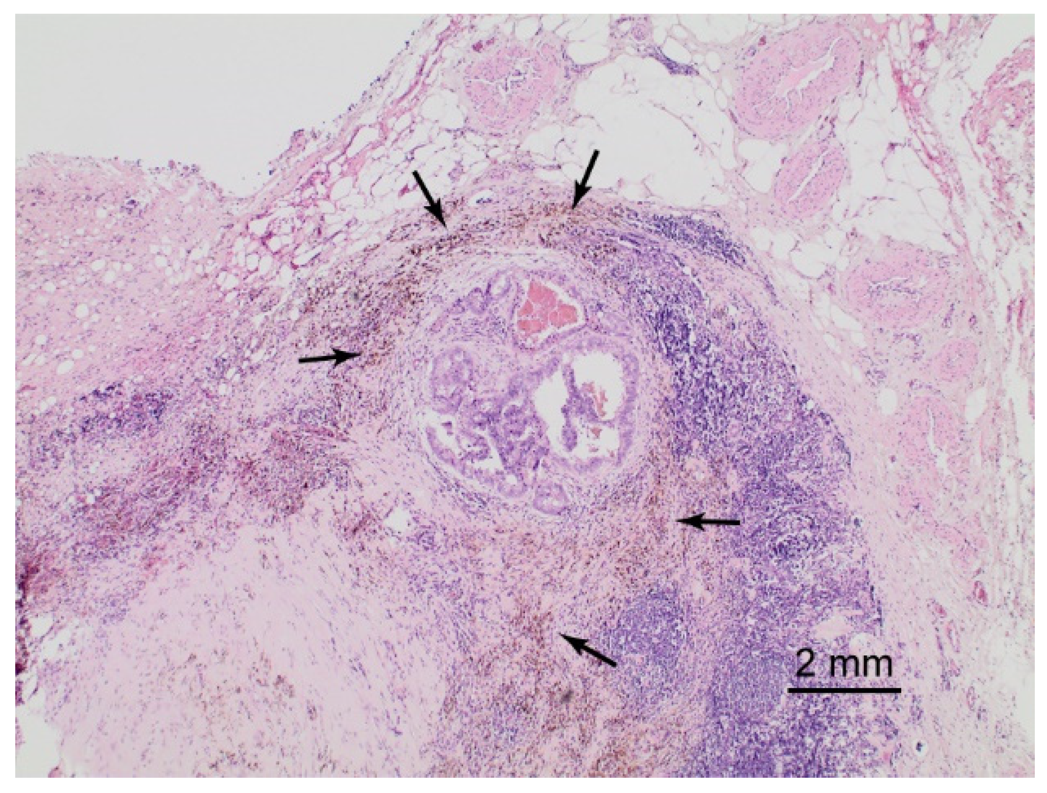 Cancers 13 05821 g001