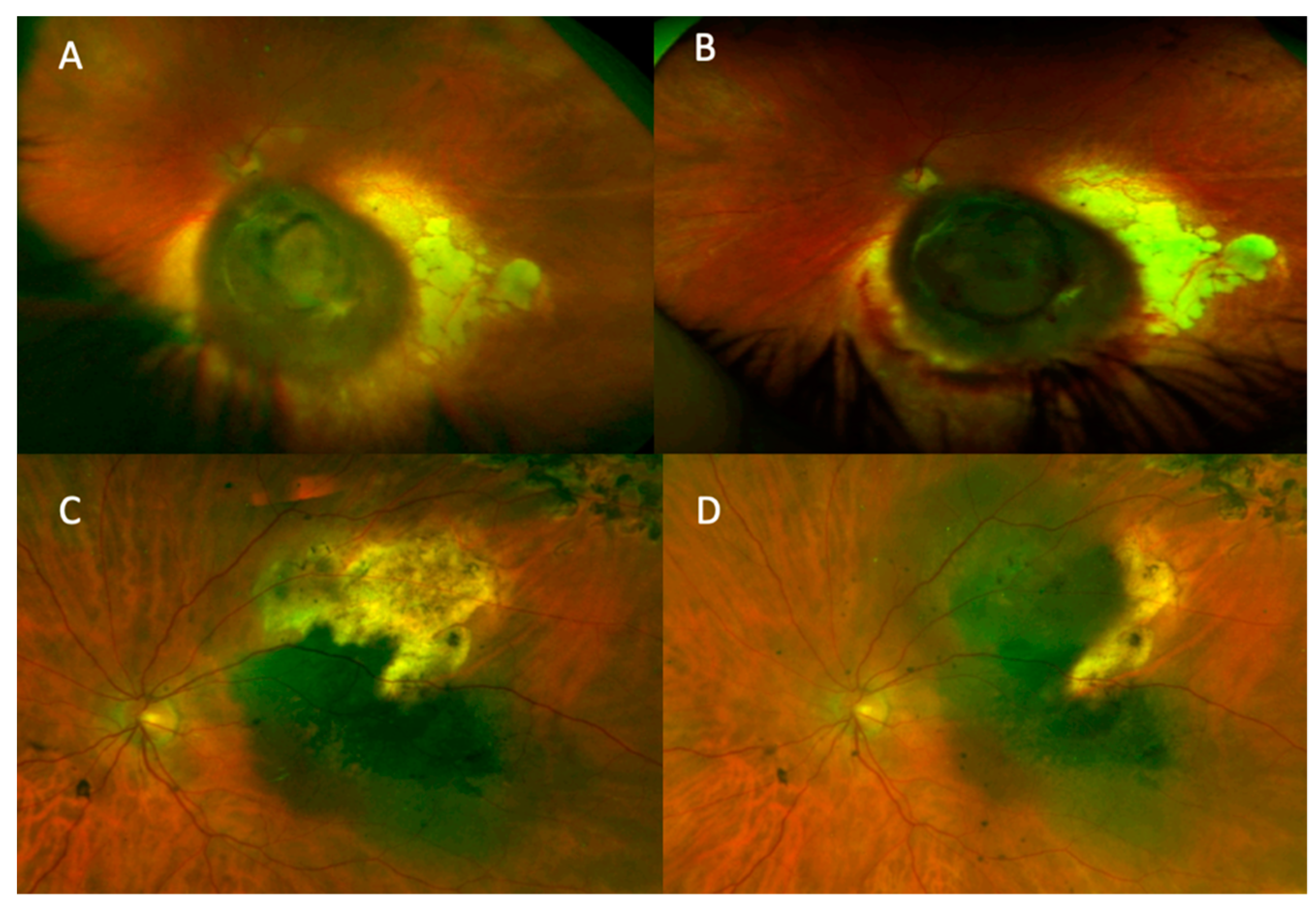 Cancers 13 05832 g001