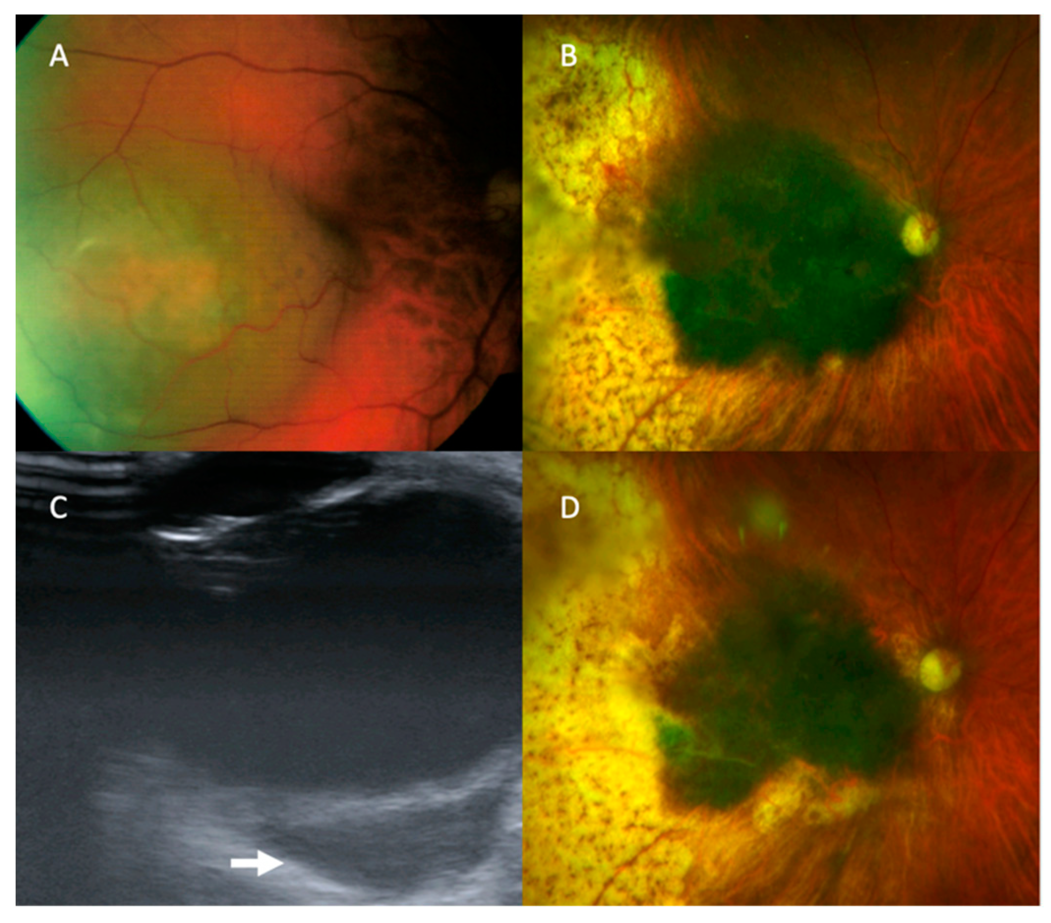 Cancers 13 05832 g002