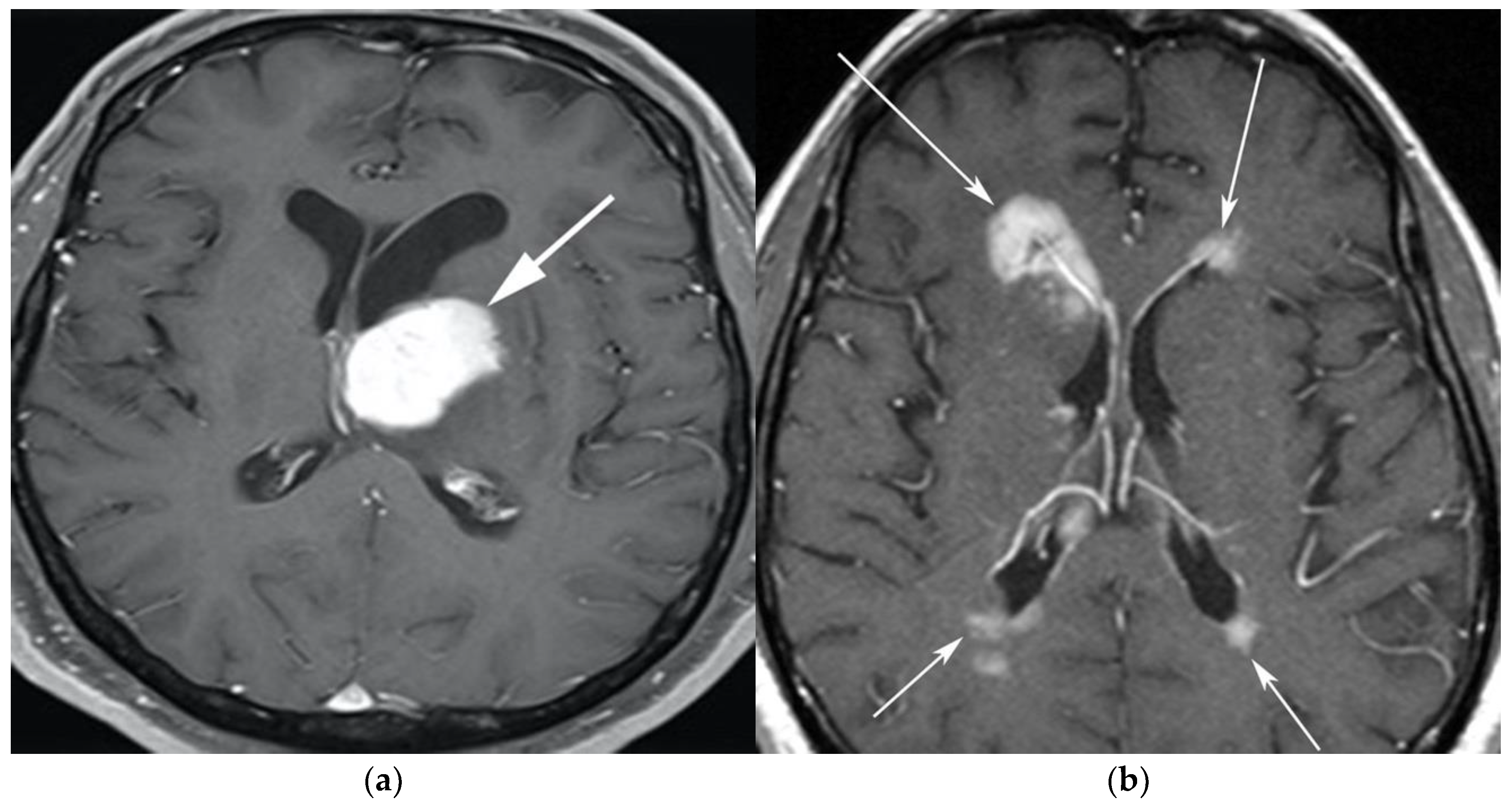 Cancers 13 05853 g001