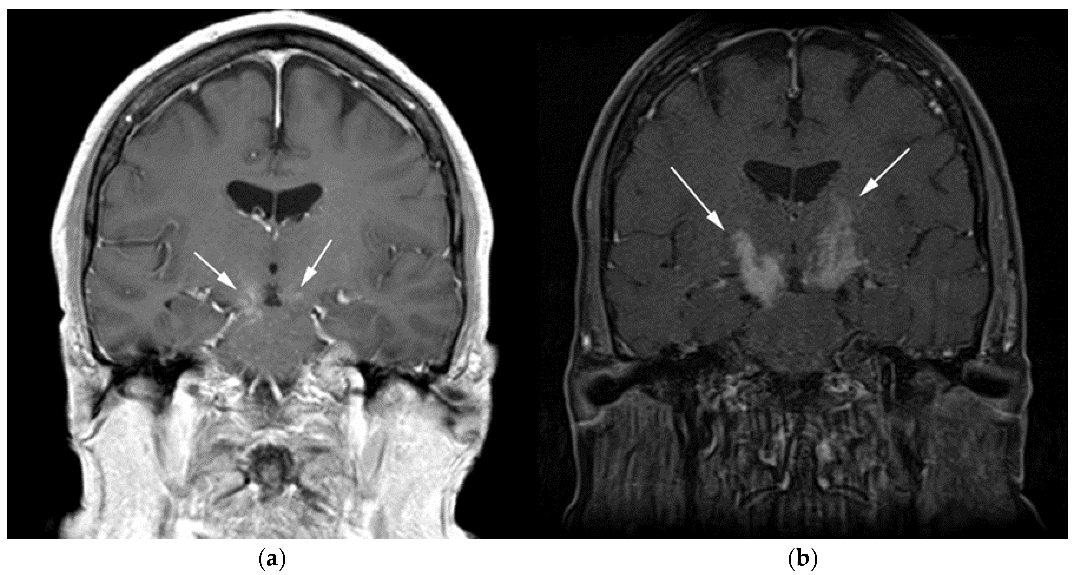 Cancers 13 05853 g002