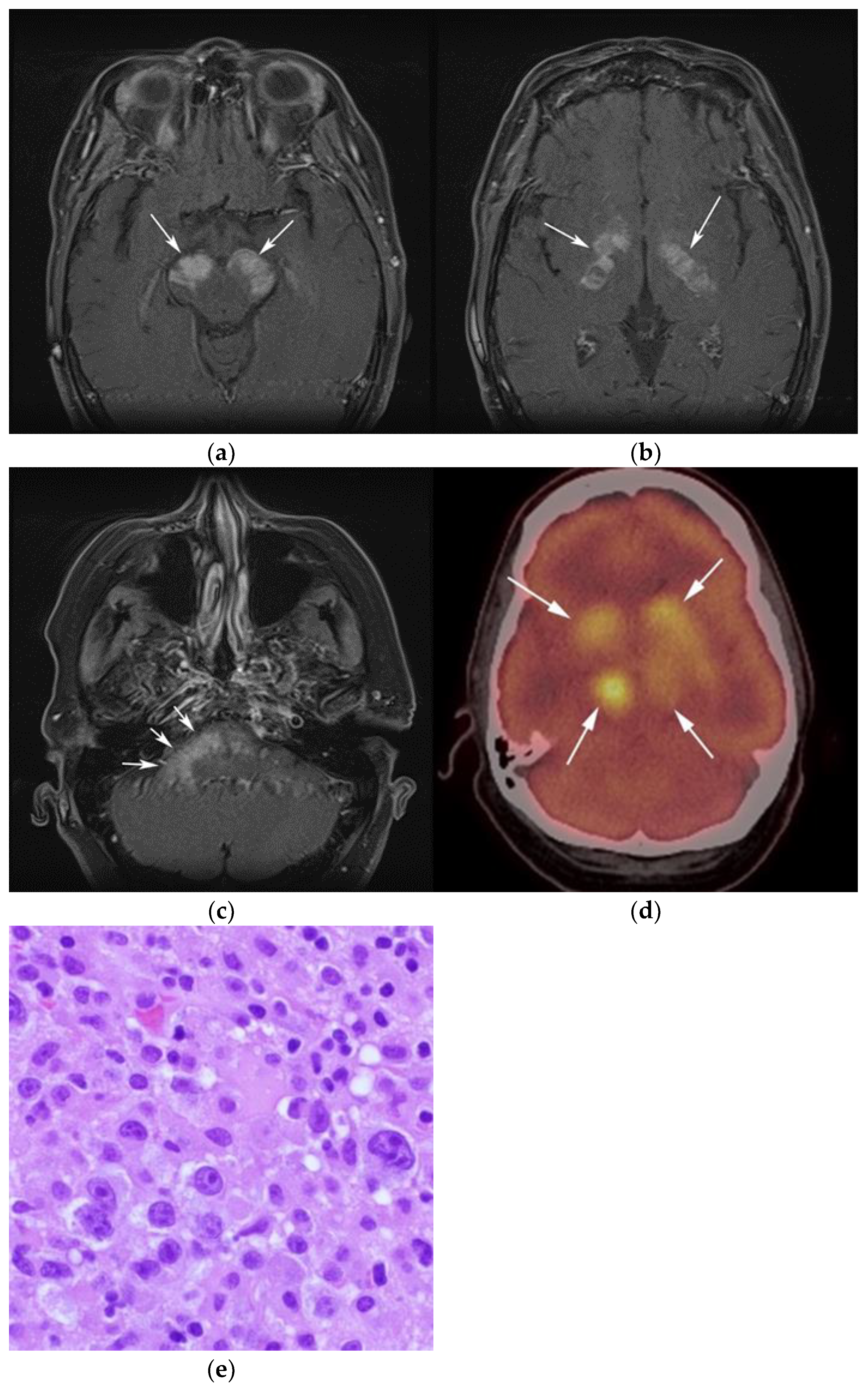 Cancers 13 05853 g003