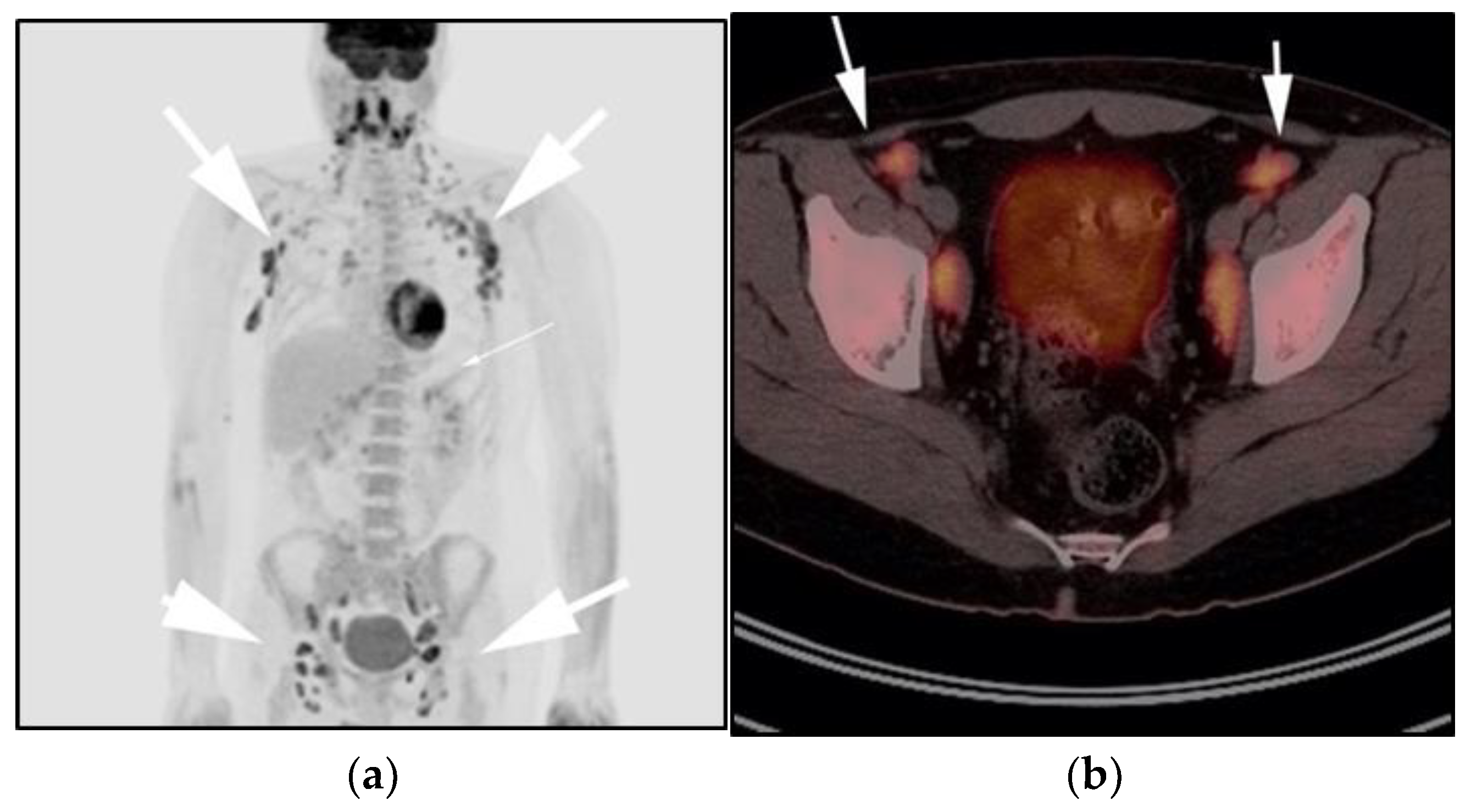 Cancers 13 05853 g004a