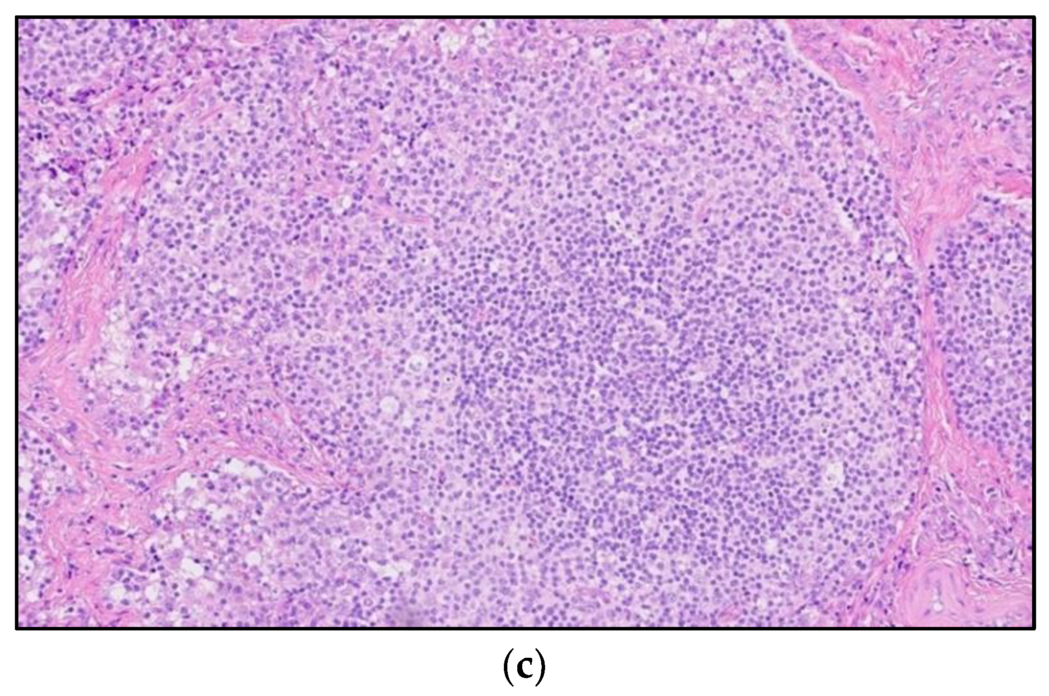 Cancers 13 05853 g004b