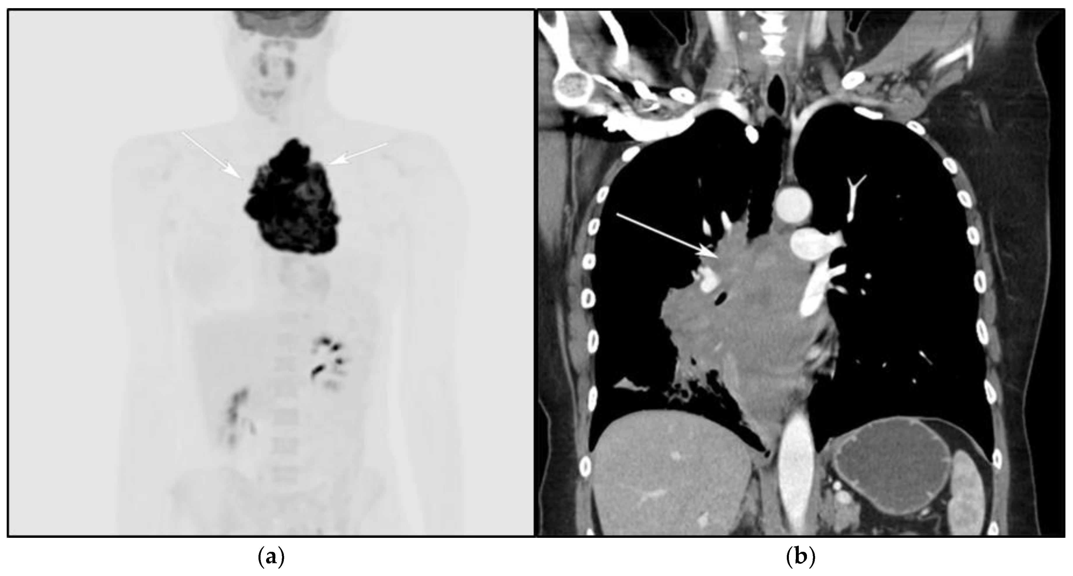 Cancers 13 05853 g005