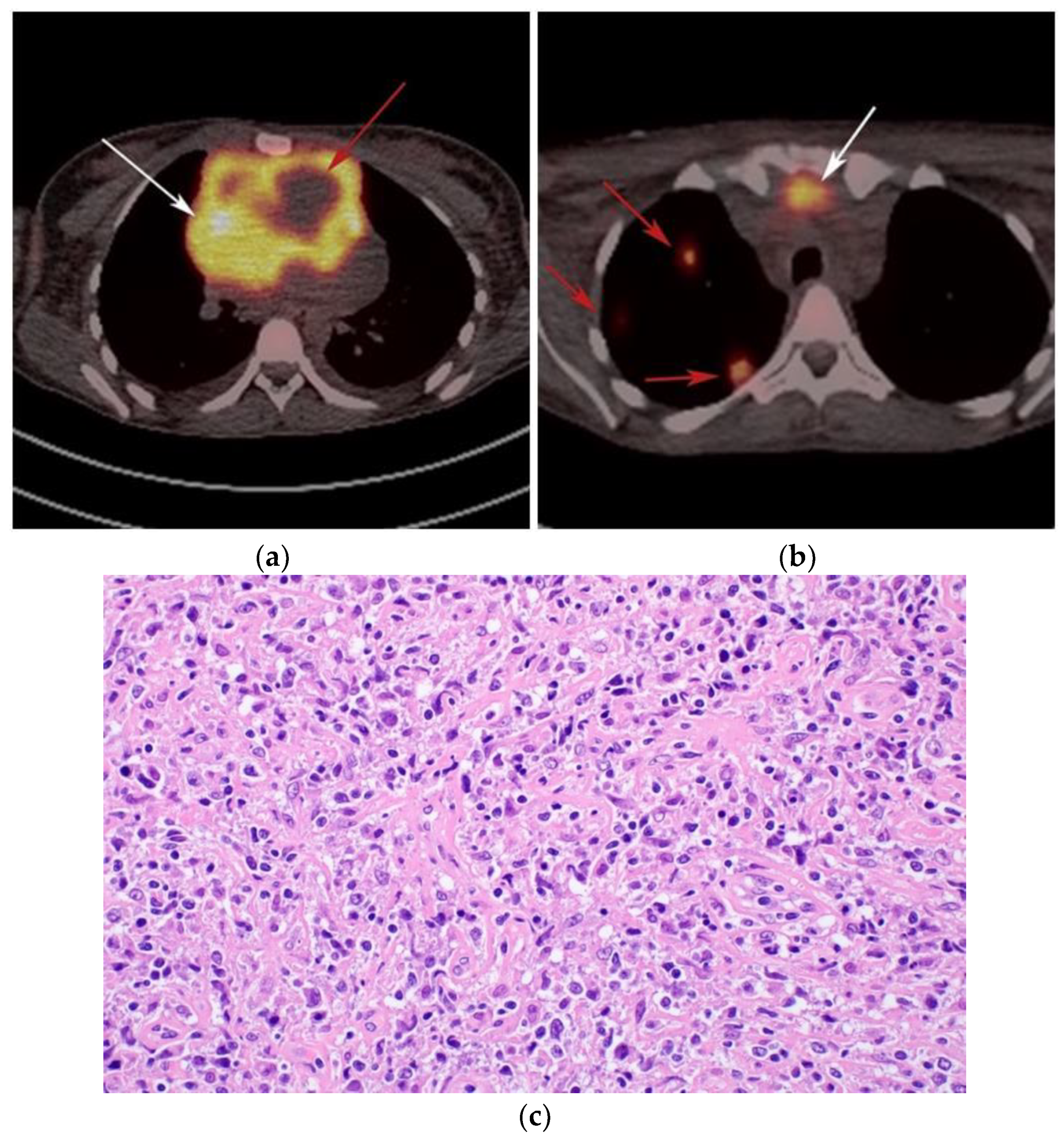 Cancers 13 05853 g006