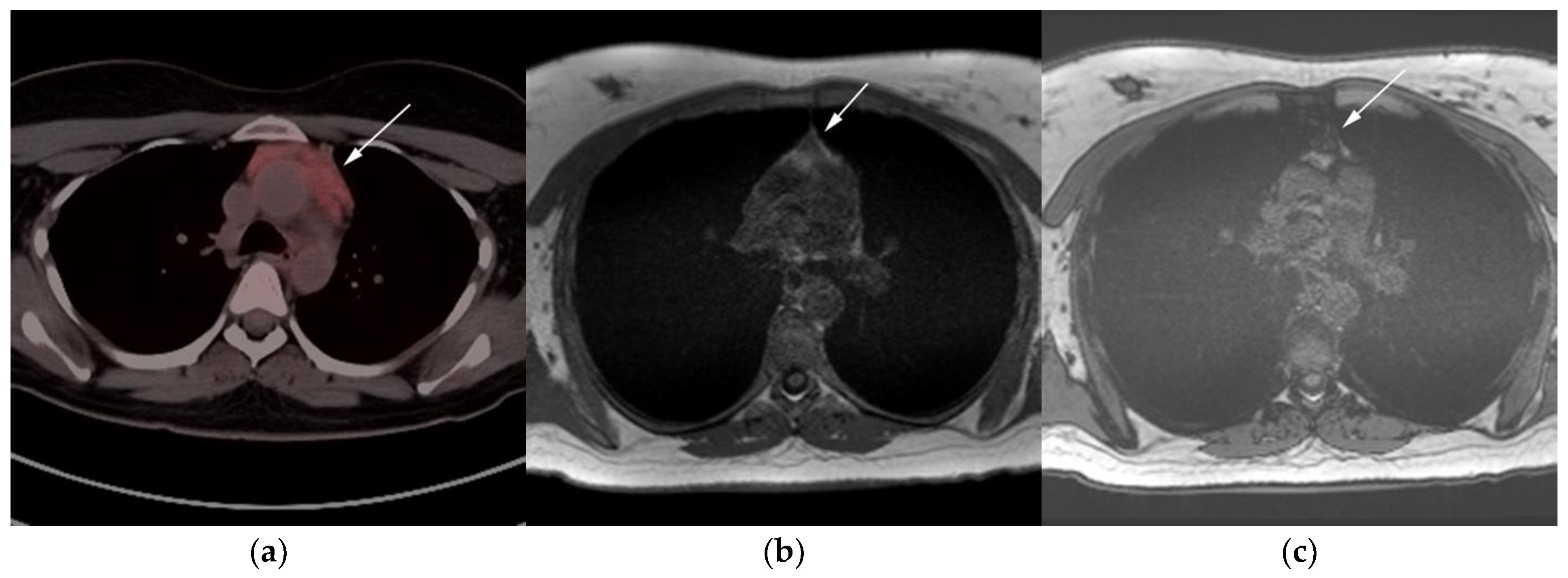 Cancers 13 05853 g007