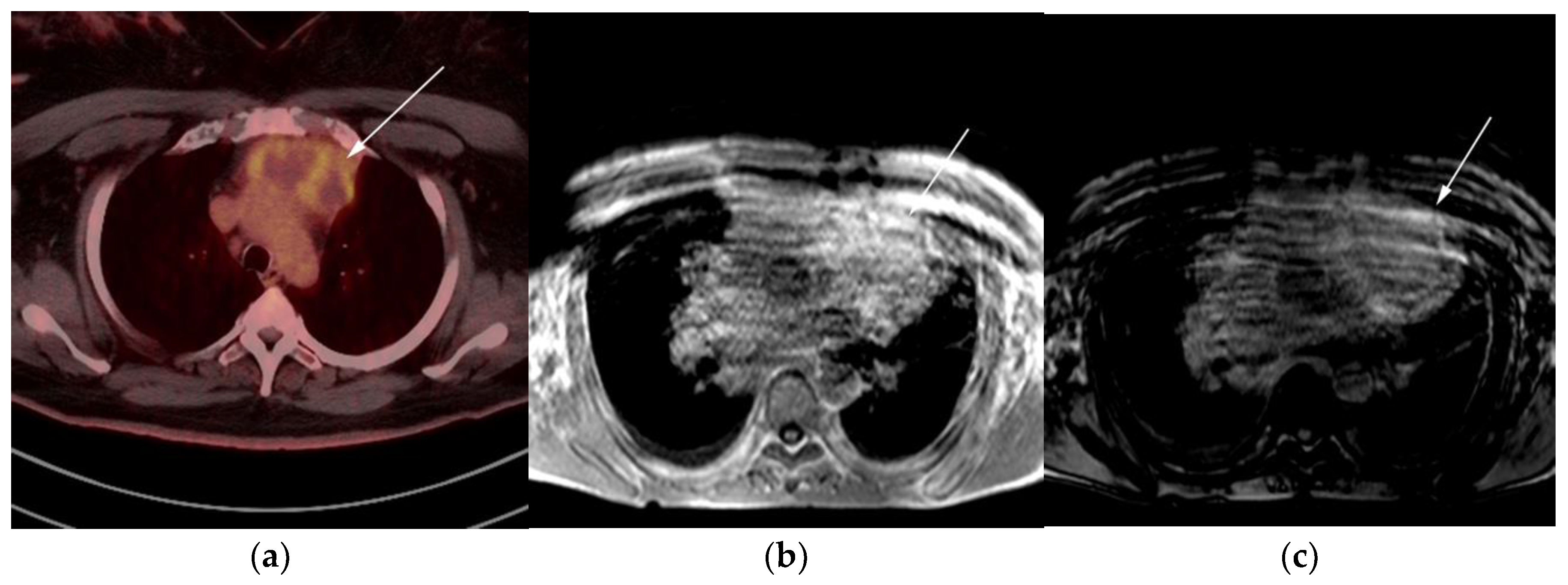 Cancers 13 05853 g008