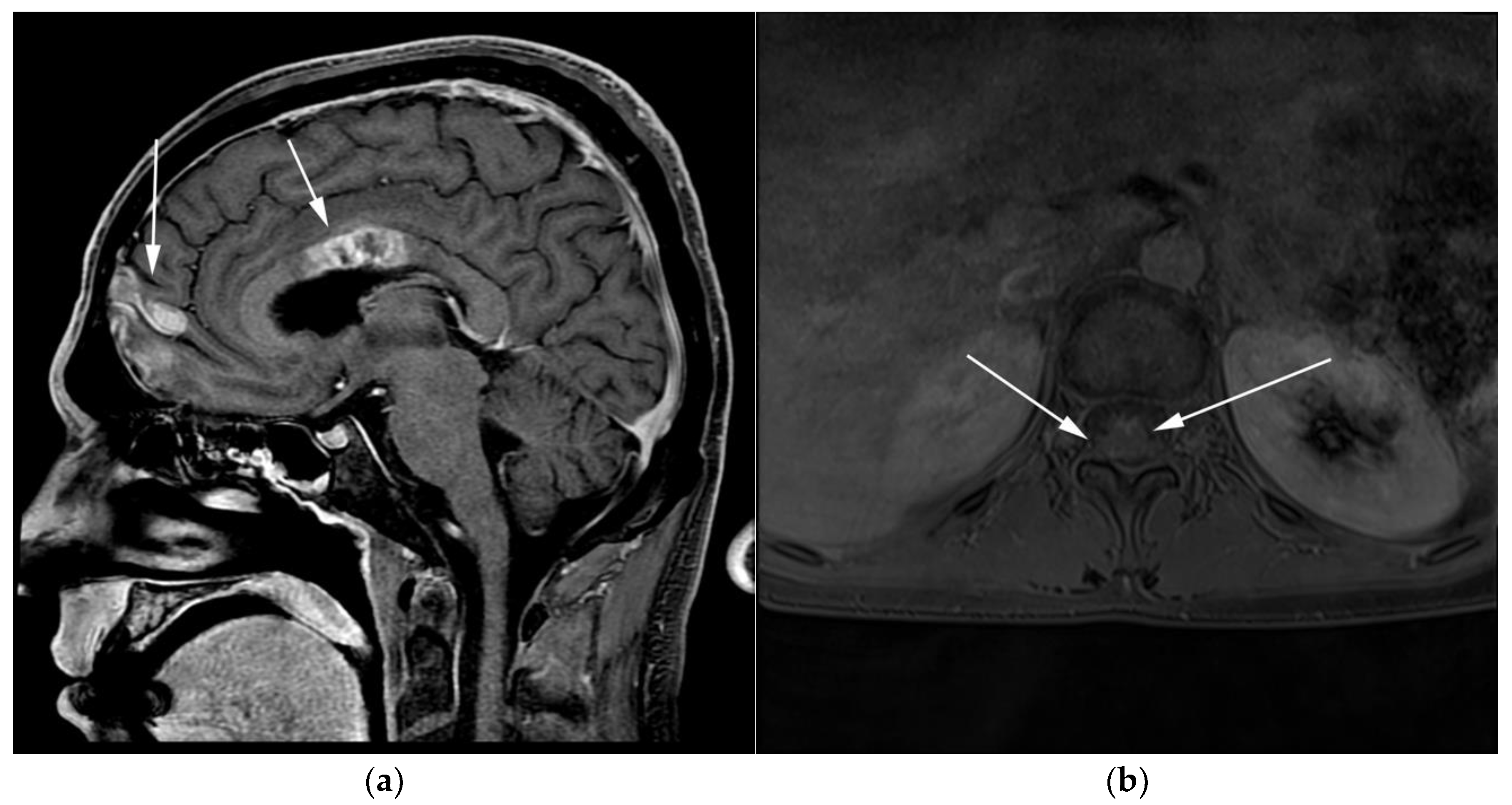 Cancers 13 05853 g010