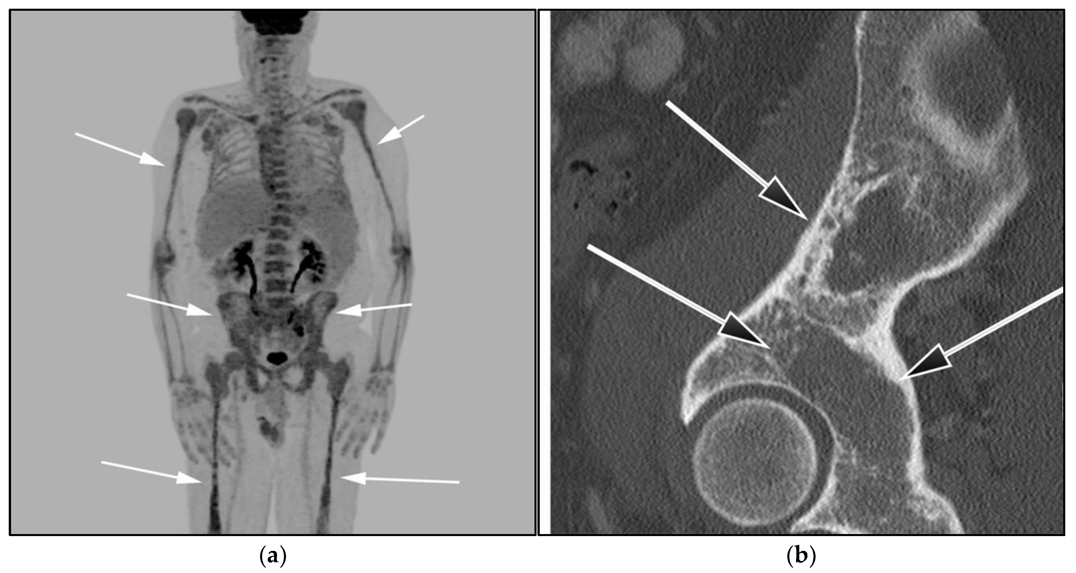 Cancers 13 05853 g011