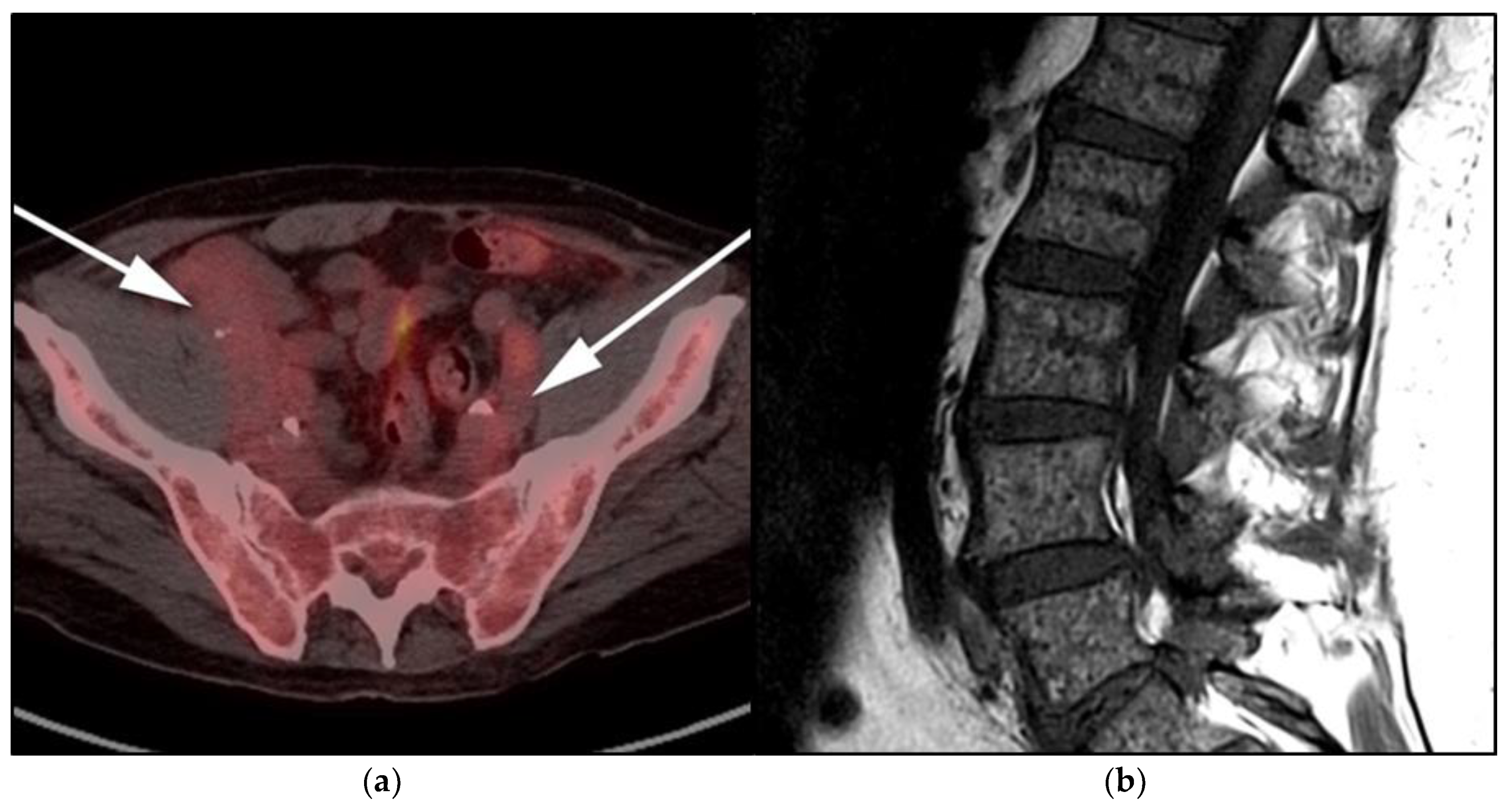 Cancers 13 05853 g012