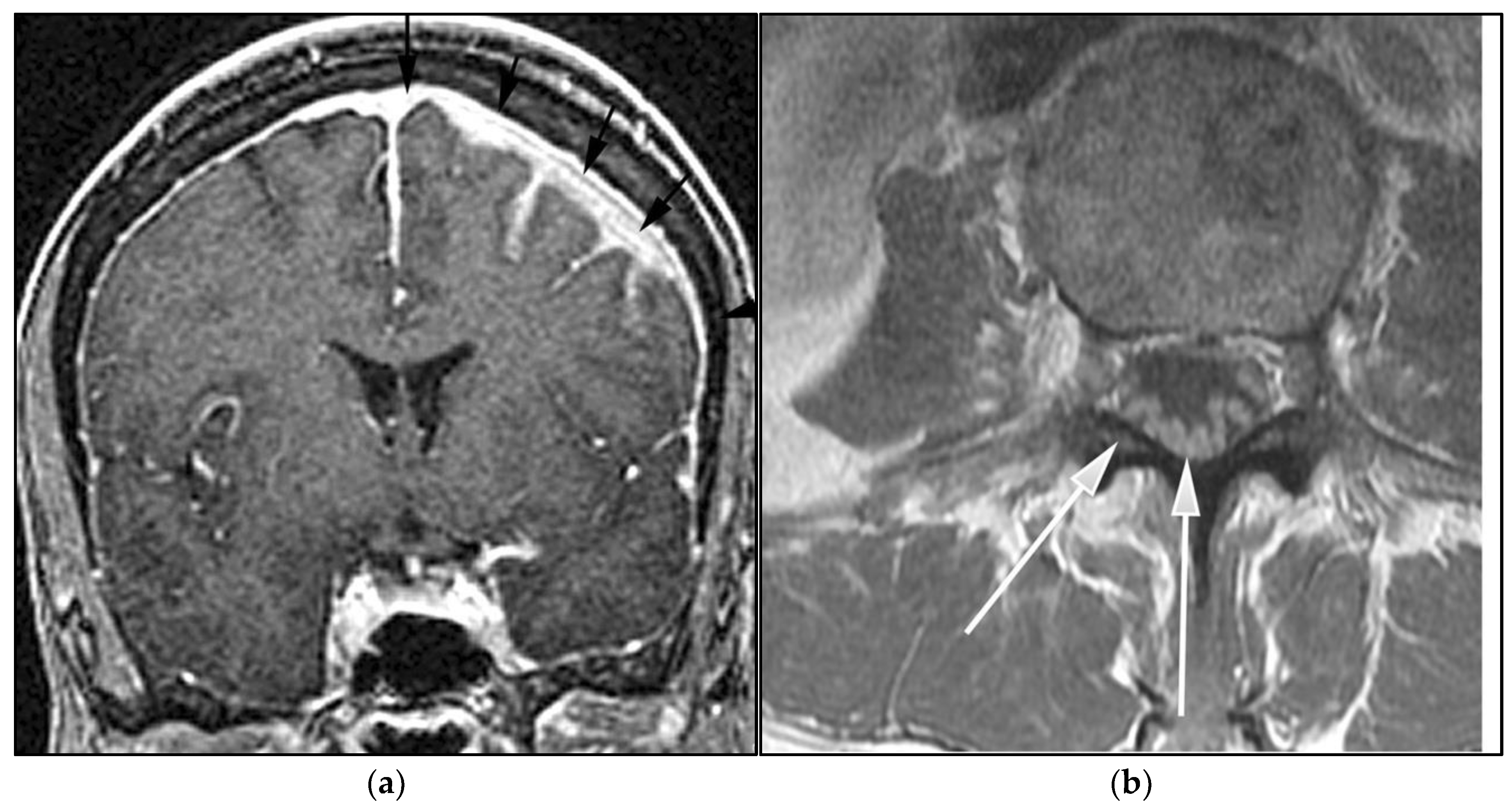Cancers 13 05853 g013a