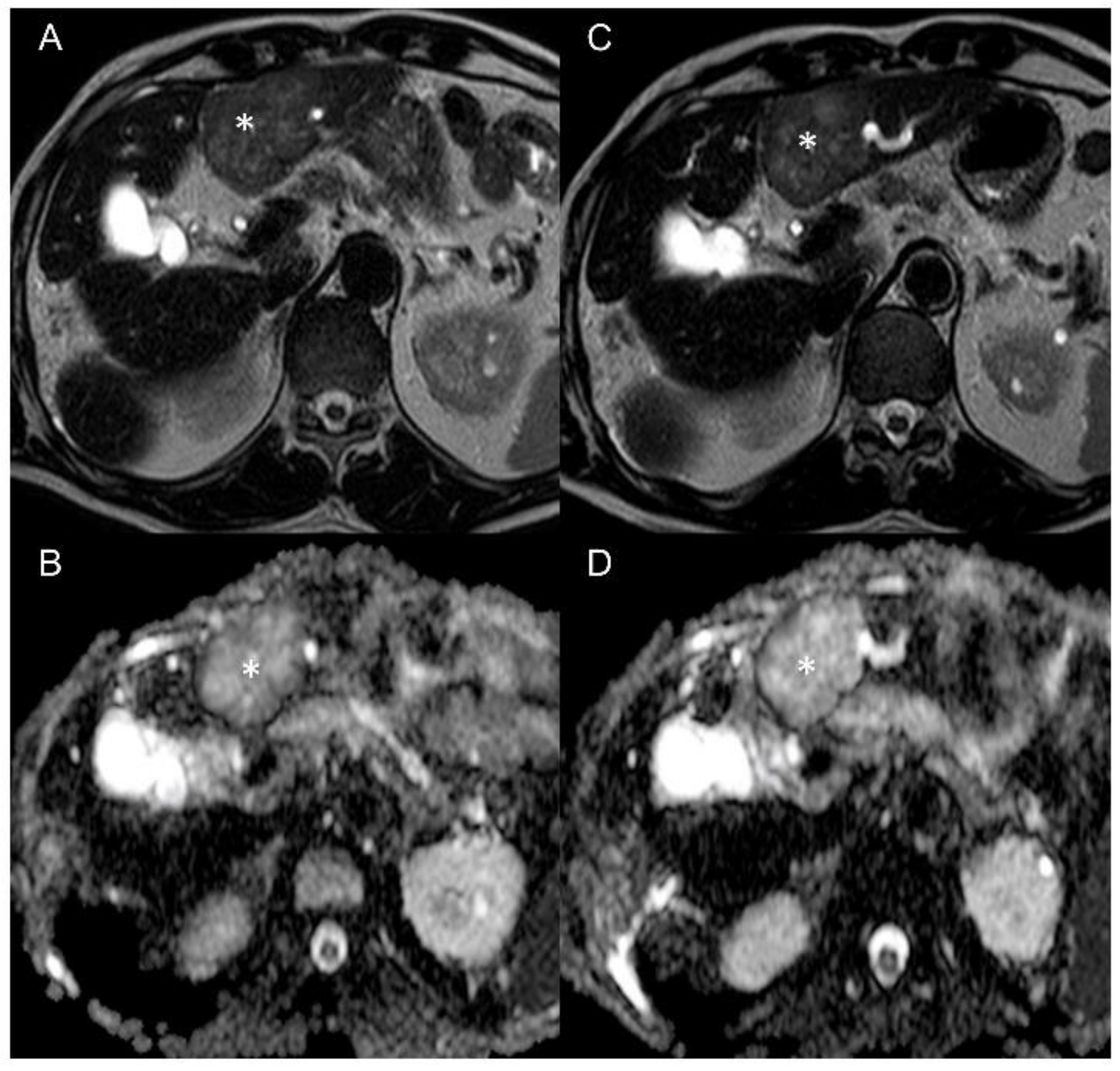 Cancers 13 05880 g003