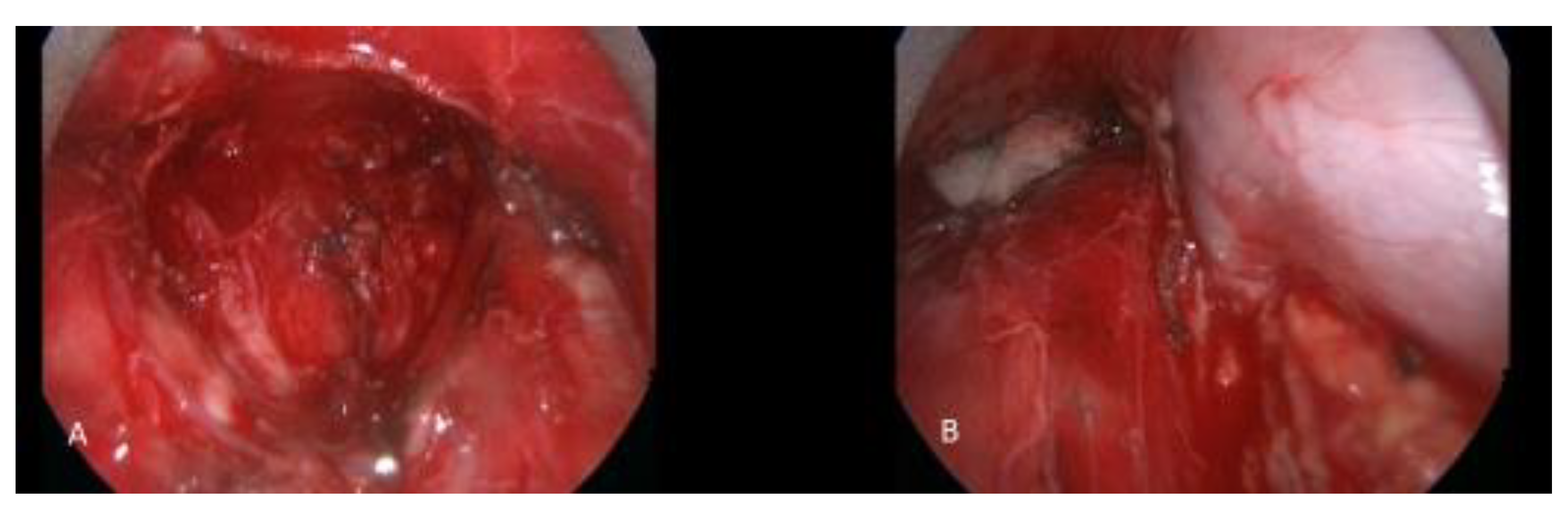 Cancers 13 05887 g002