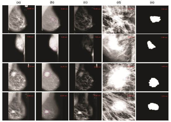 Cancers 13 05916 g004 550