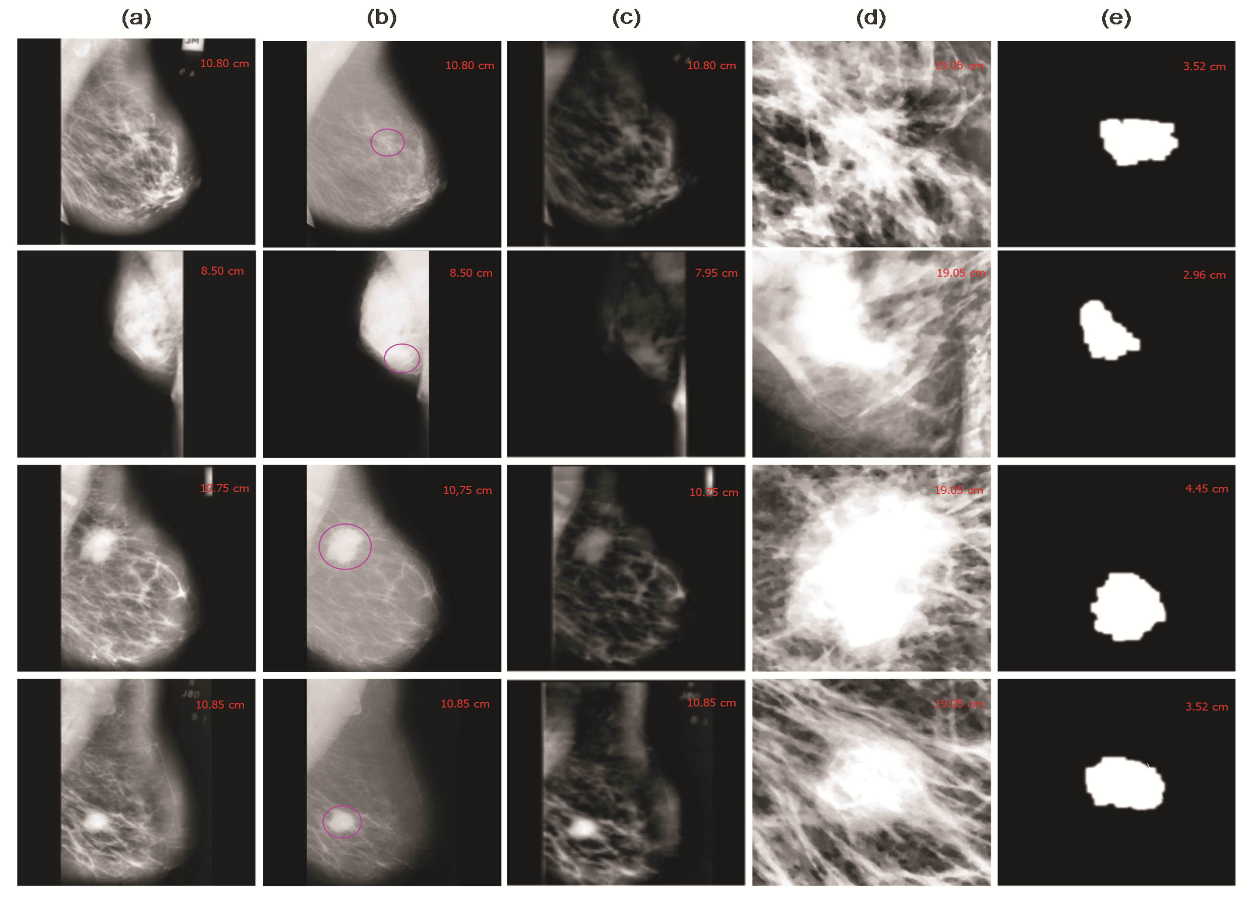 Cancers 13 05916 g004