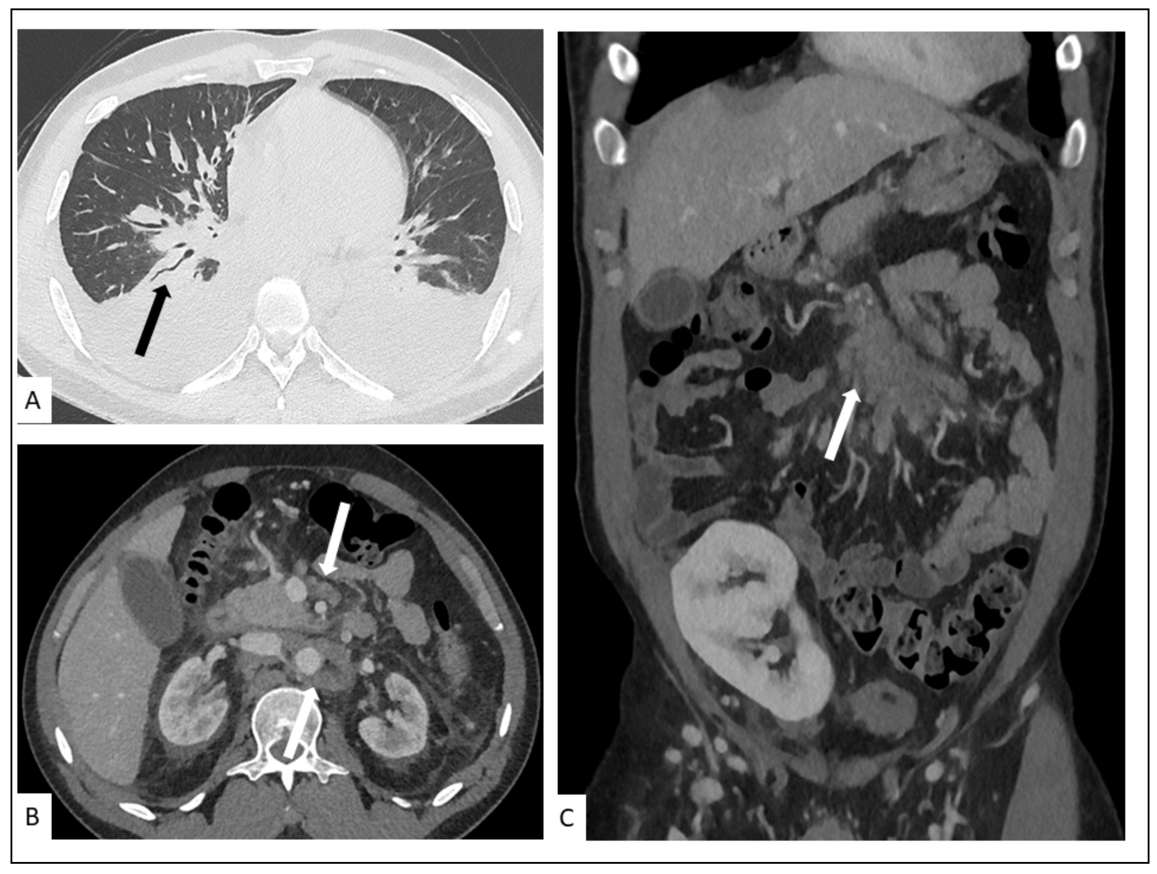 Cancers 13 05927 g005