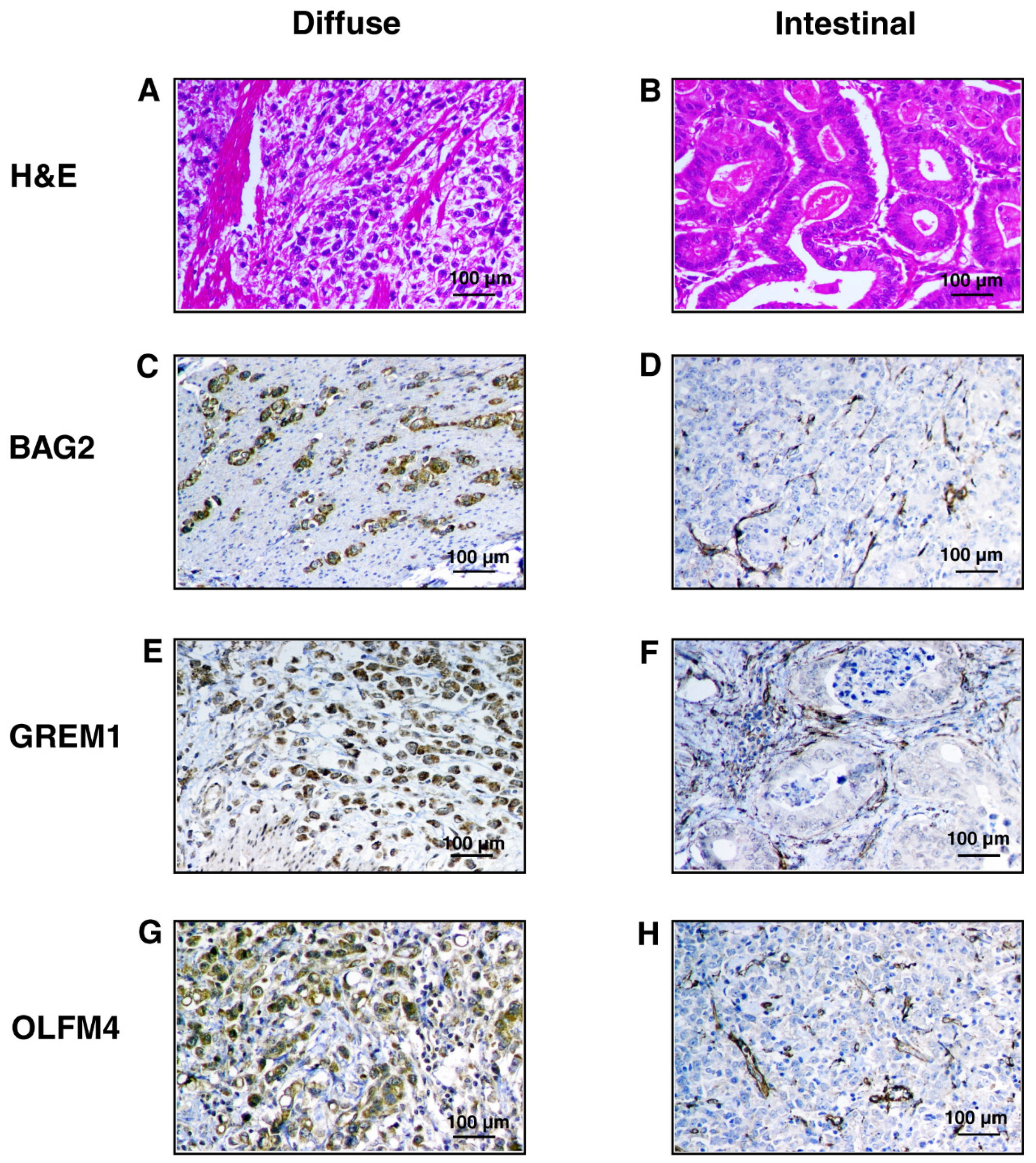 Cancers 13 05930 g006a