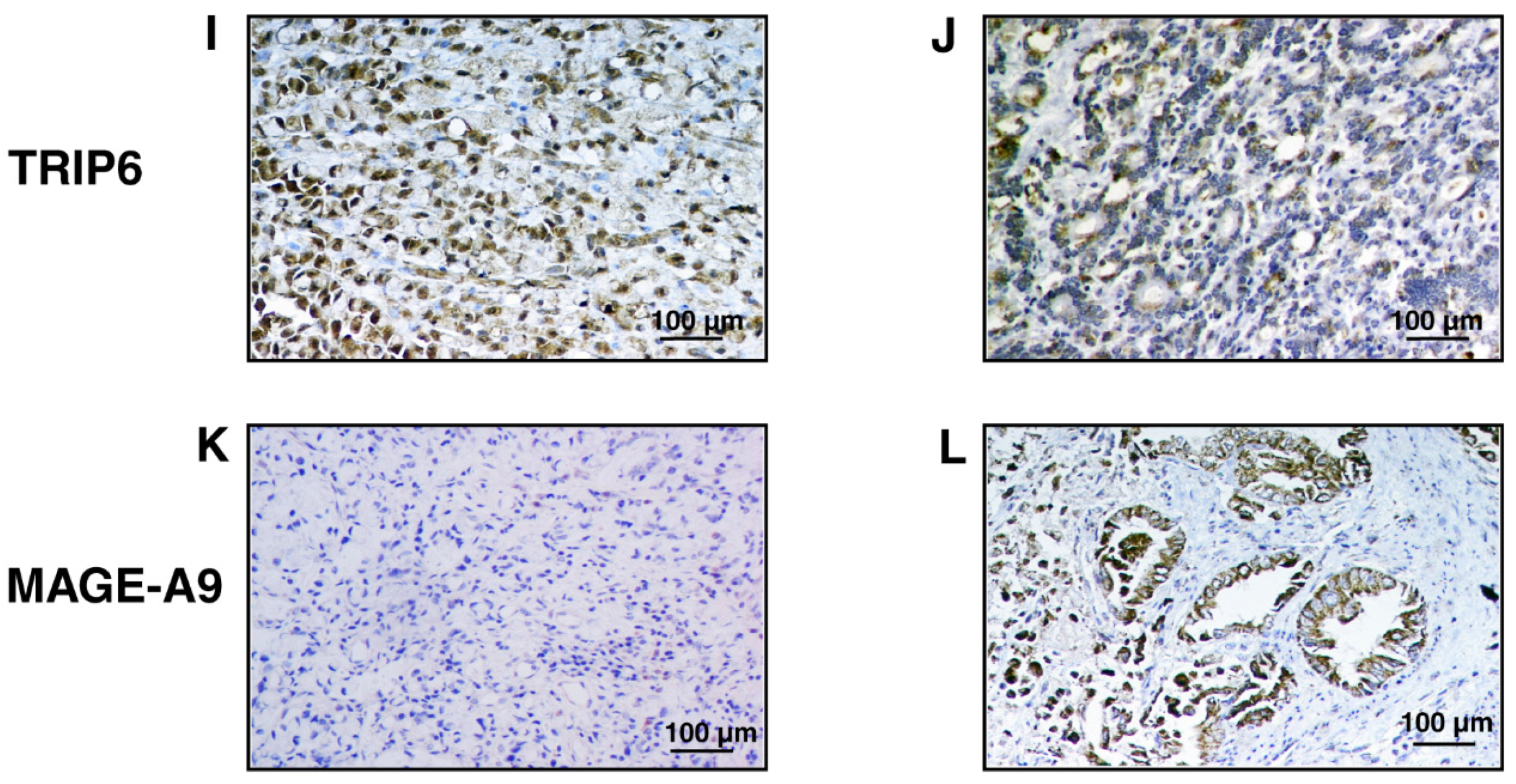 Cancers 13 05930 g006b