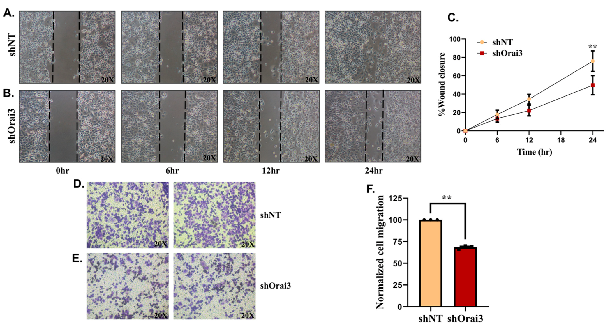 Cancers 13 05937 g007