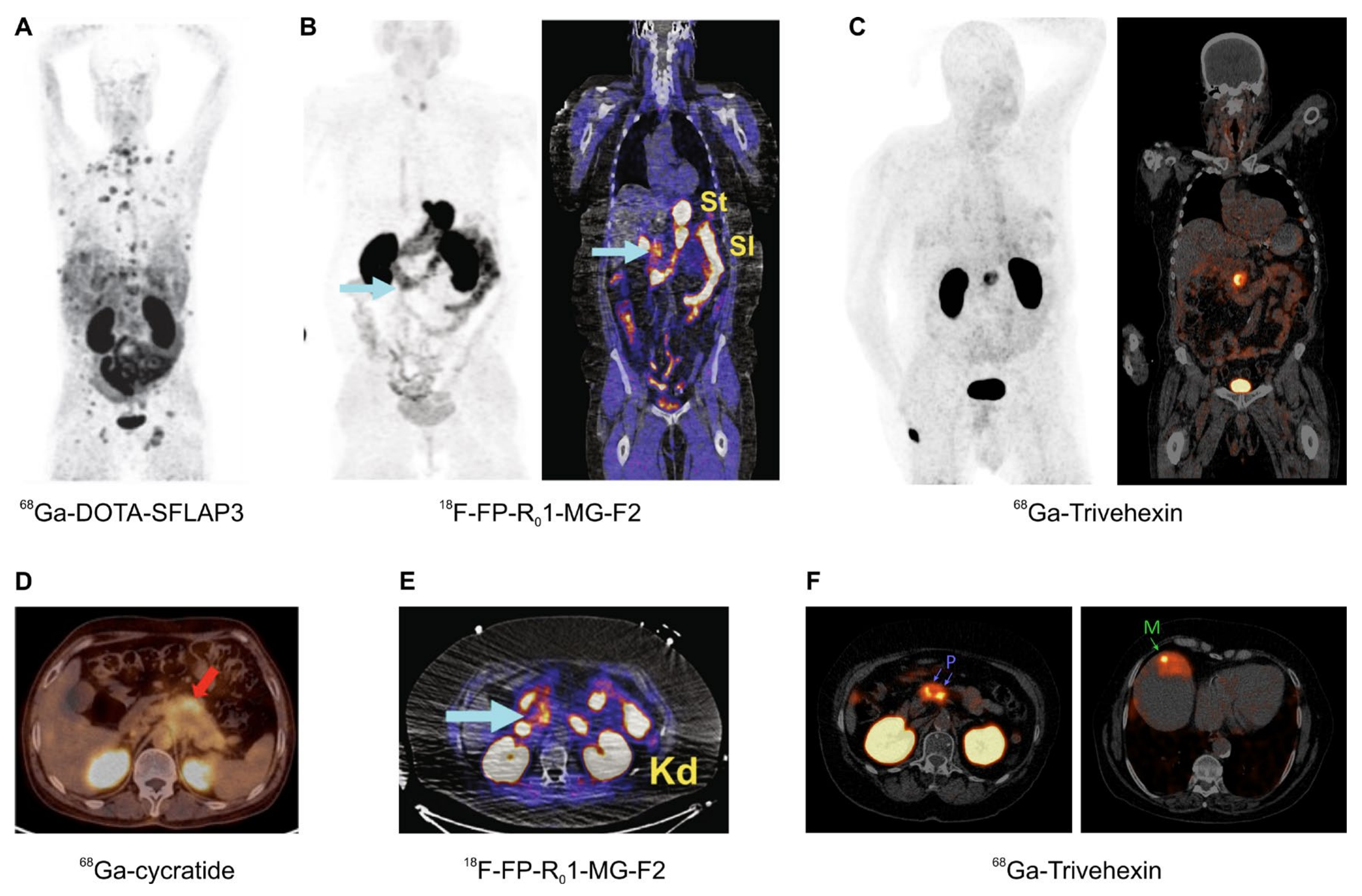 Cancers 13 05958 g006