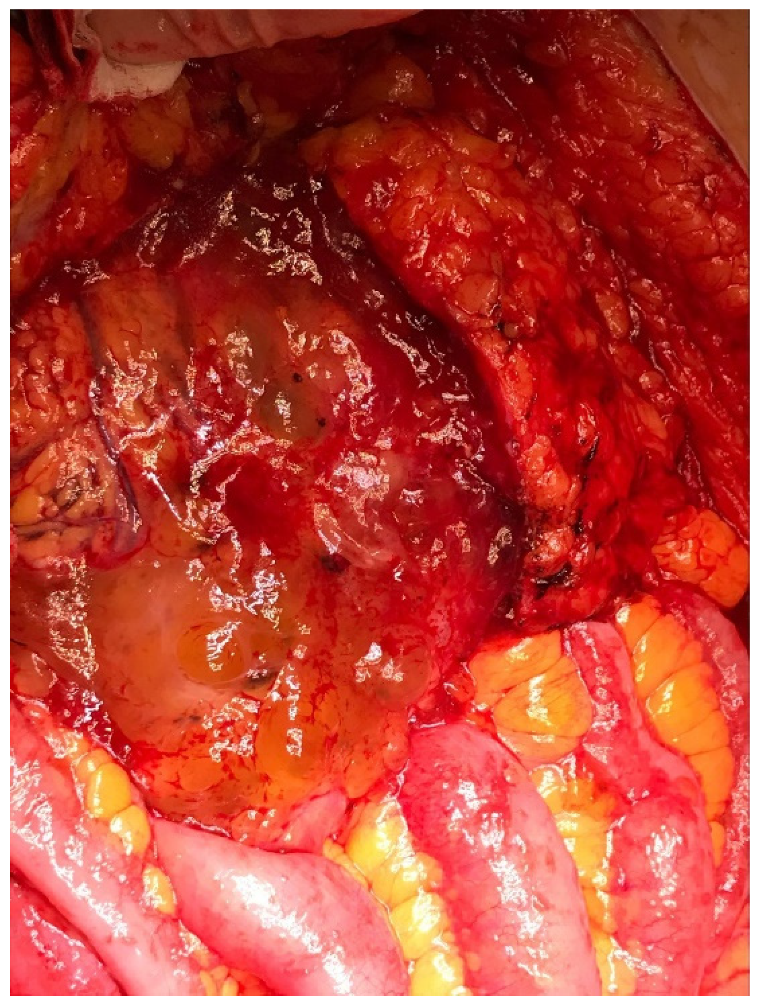 Cancers 13 05965 g001