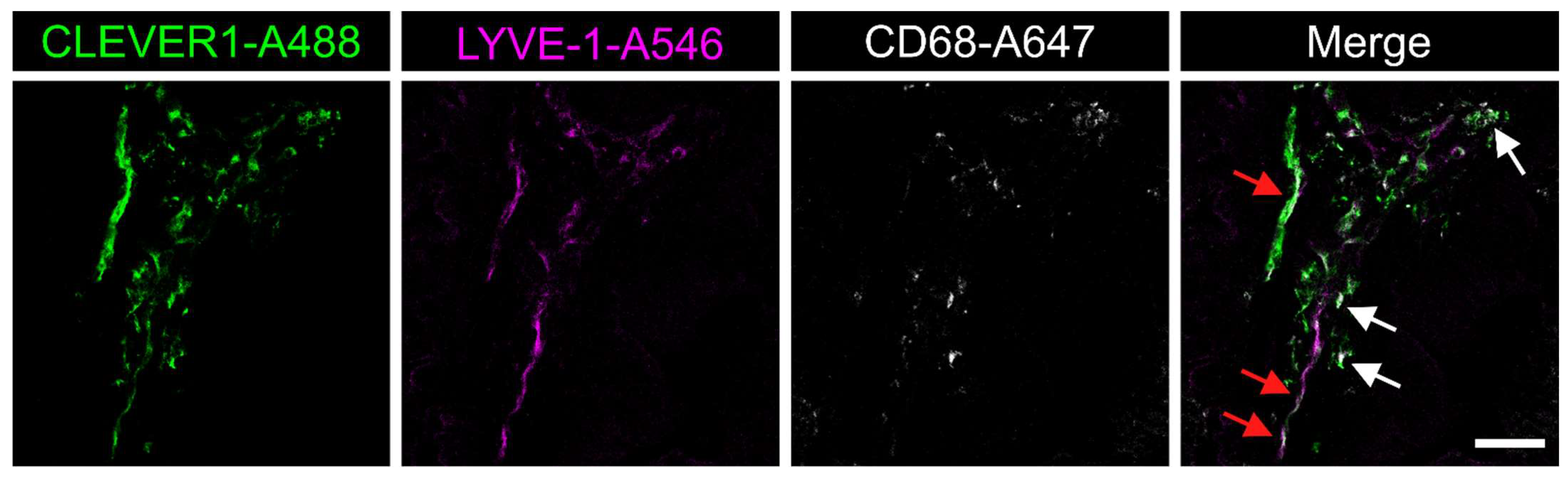 Cancers 13 05988 g004